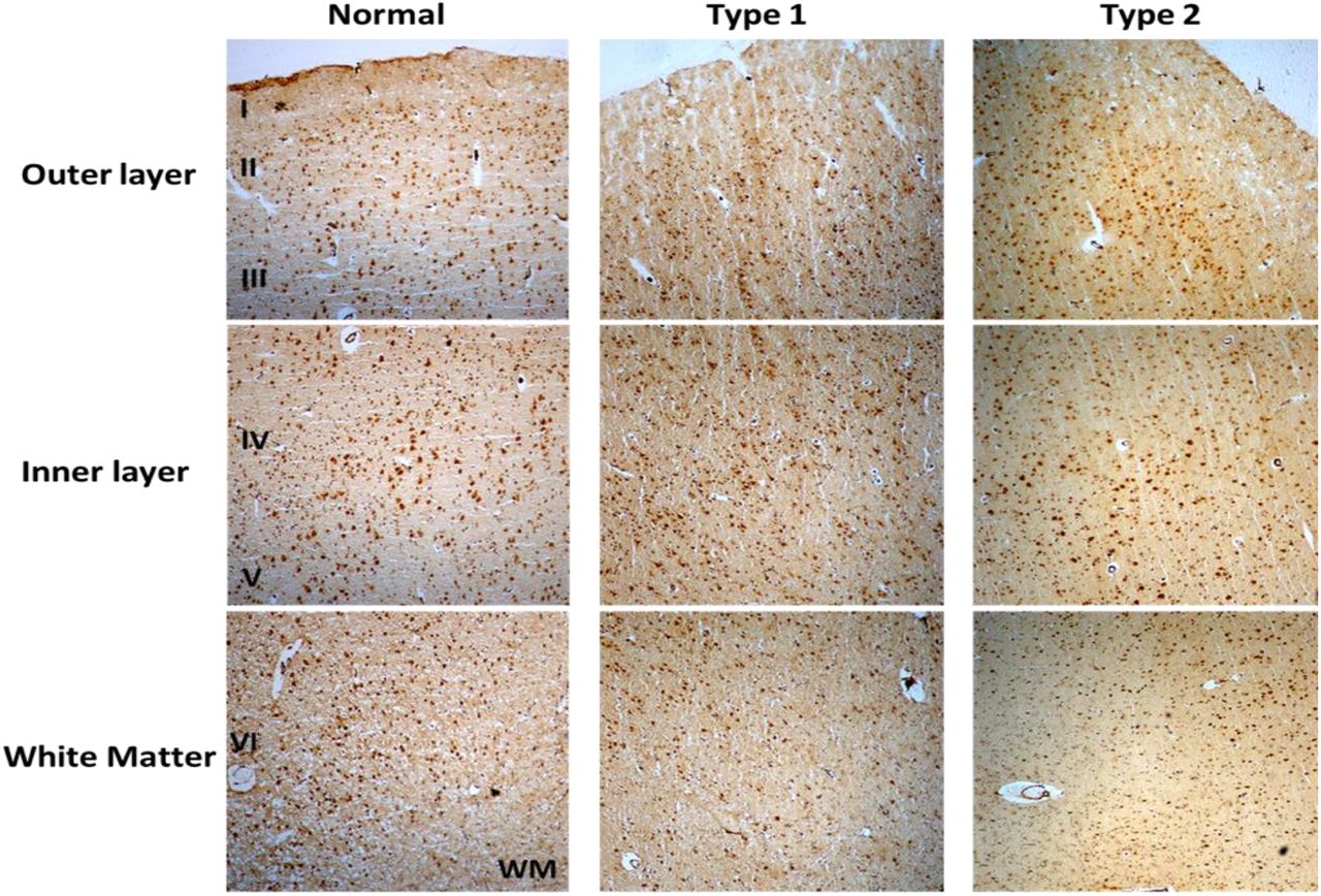 Immunohistochemistry of <t>S1PR1</t> in control and schizophrenia DLPFC.