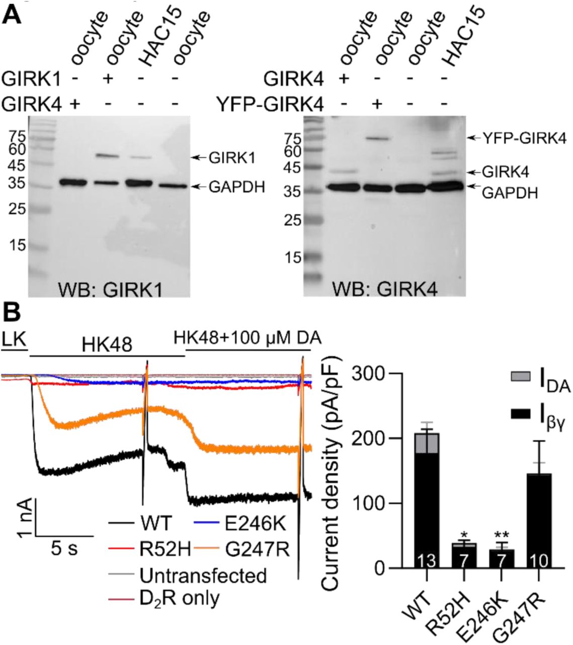 ... antibody (both panels) and GIRK1 antibody (left) and GIRK4 antibody (right) show that HAC15 cells express GIRK1 ... (A) Western blots of HAC15 cells with GAPDH antibody (both panels) and GIRK1 antibody (left) and GIRK4 antibody (right) show that HAC15 cells express GIRK1 and GIRK4 channels. Oocytes expressing GIRK1, GIRK4, and YFP-GIRK4 were used as positive controls, naïve oocytes as negative control, and GAPDH as loading control. (B) Examples (left) and summary (right) of currents in HAC15 cells expressing GFP-GIRK1/GIRK4 WT , GFP-GIRK1/GIRK4 R52H , GFP-GIRK1/GIRK4 E246K , and GFP-GIRK1/GIRK4 G247R . Channels were expressed with D 2 dopamine receptor and Gβγ (I βγ ), thus the small I DA .