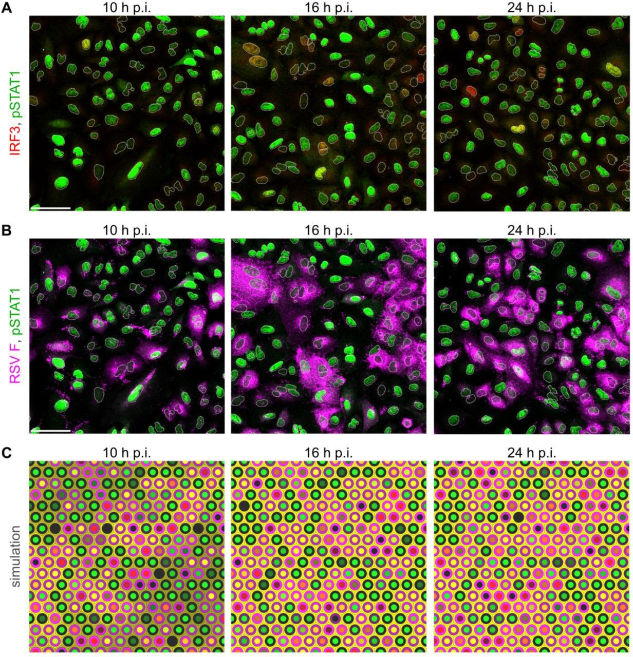 ... (p.i.) with RSV at an MOI of 1. IRF3 – red (intracellular, only in panel A), RSV ... A, B A549 cells 10, 16, and 24 hours post infection (p.i.) with RSV at an MOI of 1. IRF3 – red (intracellular, only in panel A), RSV – magenta (only in panel B), p-STAT1 – green. White dotted lines are nuclear outlines determined based on DAPI counterstaining (channel not shown). Scale bars, 50 µm. C Snapshots from a simulation of infection at an MOI of 1 in a compact monolayer of cells (subpanels show small fragments of a simulated 100×100 lattice).