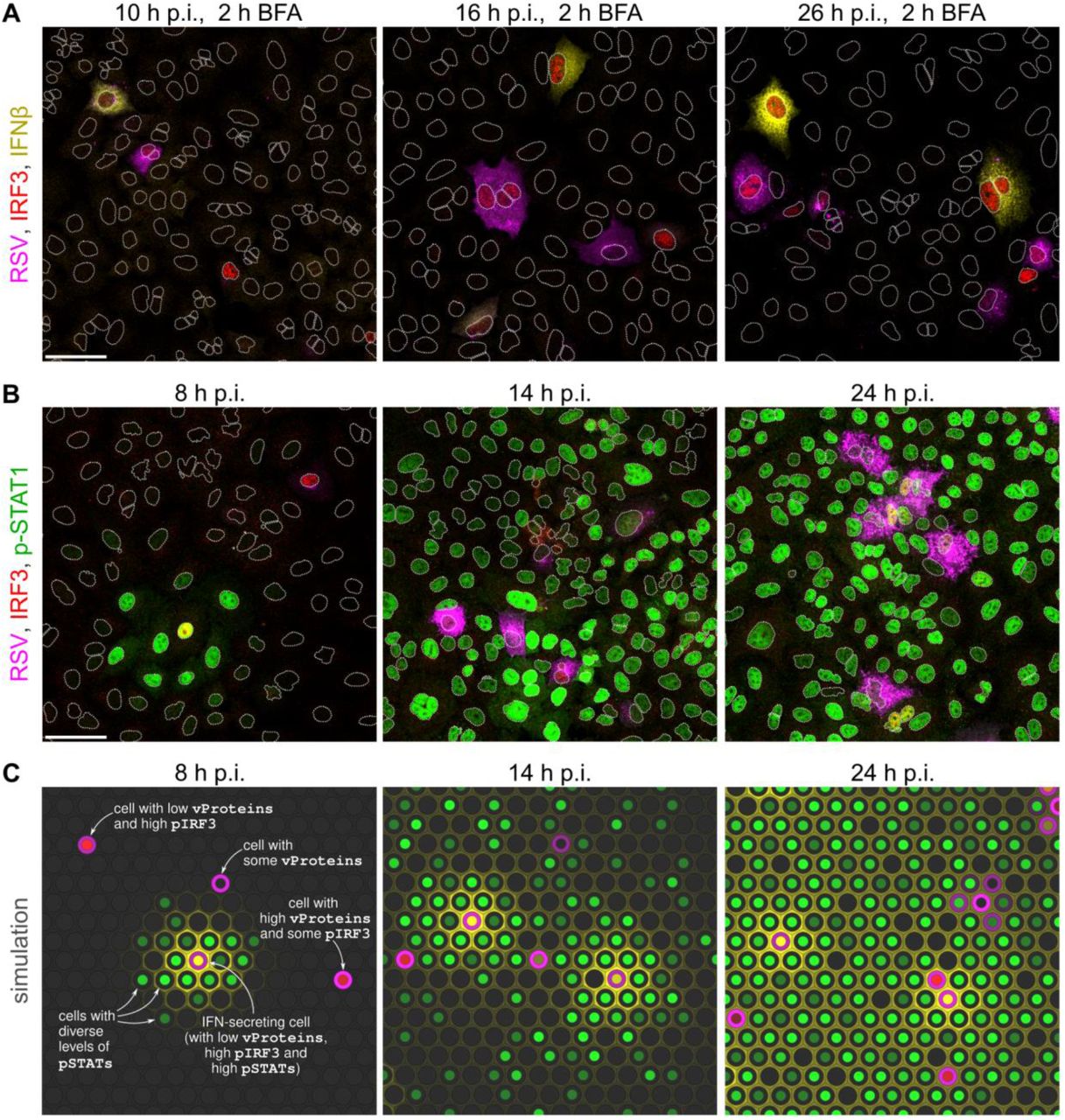 A, B Overlays of images of A549 cells at three time points post infection (p.i.) with RSV at an MOI of 0.01, immunostained for: RSV proteins (polyclonal antibody) – magenta, <t>IRF3</t> – red, (intracellular) IFNβ – yellow (only in panel A), phospho-Tyr701 STAT1 (p-STAT1) – green (only in panel B). The 2 h-long treatment with brefeldin A (BFA, in panel A) prevented secretion of IFNβ produced during the treatment. When phosphorylated, IRF3 translocates to the nucleus giving a discernible signal. White dotted lines are nuclear outlines determined based on DAPI counterstaining (channel not shown). Scale bars, 50 µm. C Snapshots from a simulation of infection at an MOI of 0.01 in a compact monolayer of cells (subpanels show fragments of a simulated 100×100 lattice). The color key corresponds to pseudocolors of immunostained proteins used in panels A, B (concentration of IFNβ in the lower subcompartment is indicated at hexagon borders; yellow color in nuclei results from mixing of red and green).