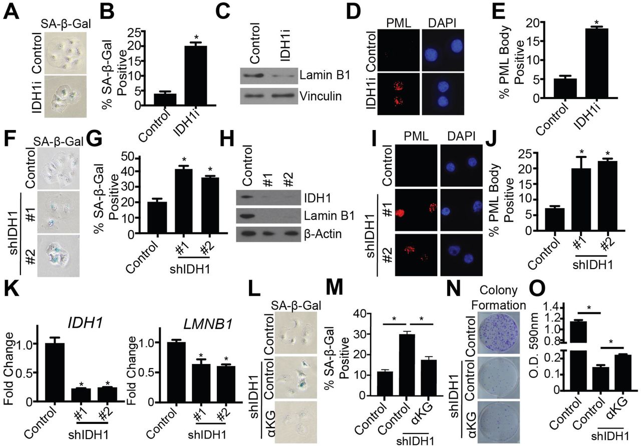 ... infected with lentivirus expressing two independent shRNAs targeting IDH1. Empty vector was used as a control. Cells ... (A-E) Ovcar3 cells were treated with either DMSO or 15μM GSK864 (IDH1i) for 7 days. (A) SA-β-Gal activity. One of three experiments is shown. (B) Quantification of (A). Data represent mean ± SD. *p<0.0001 (C) Immunoblot analysis of lamin B1. One of three experiments is shown. (D) PML body foci. One of three experiments is shown. (E) Quantification of (D). Data represent mean ± SD. *p<0.0001 (F-J) Ovcar3 cells were infected with lentivirus expressing two independent shRNAs targeting IDH1. Empty vector was used as a control. Cells were selected in 3μg/mL puromycin for 7 days. (F) SA-β-Gal activity. One of three experiments is shown. (G) Quantification of (F). Data represent mean ± SD. *p<0.0001 (H) Immunoblot analysis of IDH1 and lamin B1. One of three experiments is shown. (I) PML body foci. One of three experiments is shown. (J) Quantification of (I). Data represent mean ± SD. *p<0.0005 (K) qRT-PCR analysis of IDH1 and LMNB1 (encoding Lamin B1) in Ovcar3 shIDH1 ULA. RNA was collected four days after infection. Data represent mean ± SD. *p<0.0002 (L-O) Ovcar3 cells were infected with lentivirus expressing one shRNA targeting IDH1 (#1). Empty vector was used as a control. Cells were selected in 3μg/mL puromycin for 7 days. Exogenous αKG (1mM) was added to the indicated cells. (L) SA-β-Gal activity of shIDH1 with and without αKG. One of three experiments is shown. (M)Quantification of (L). Data represent mean ± SD. *p<0.0001 (N) Colony formation of shIDH1 with and without αKG. One of three experiments is shown. (O) Quantification of (N). Data represent mean ± SD. *p<0.002