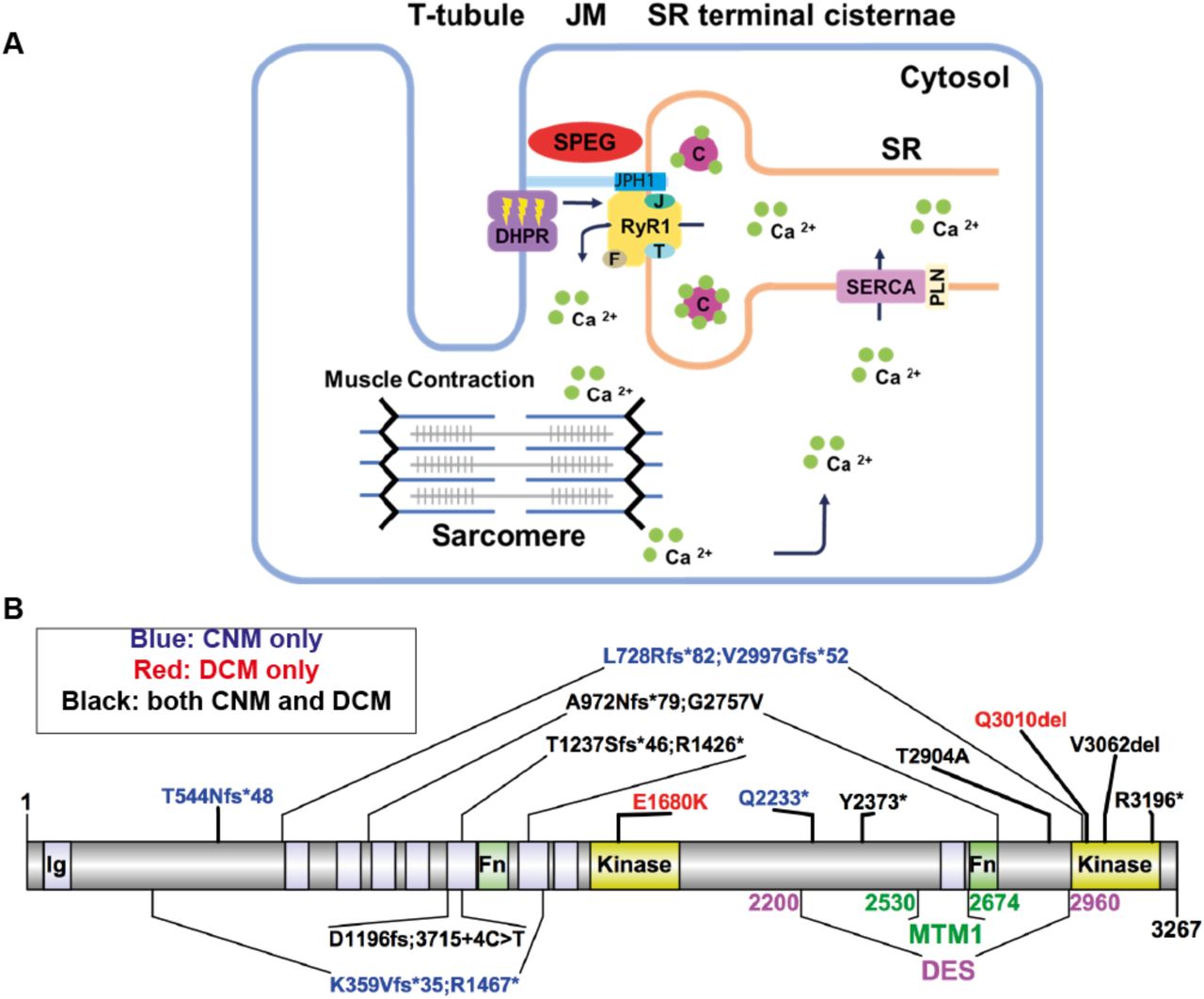 ( A ) The triads are made of transverse tubules (T-tubules) flanked by terminal sarcoplasmic reticulum (tSR). Junctional membranes (JM) are connected by the interaction of the <t>ryanodine</t> <t>receptor</t> <t>(RyR1)</t> at the tSR, and dihydropyridine receptor (DHPR) at the T-tubules, forming the core components of the ECC machinery. ECC starts when a neuronal action potential arrives via T-tubules and causes a conformational change in DHPR, allowing it to interact with <t>RyR1,</t> causing its activation. As a result, calcium (Ca 2+ ) leaves the SR via RyR1 channel opening and moves into the cytosol, promoting sarcomeric contraction. Finally, RyR1 is closed and the calcium transporter SERCA (sarco/endoplasmic reticulum Ca2+-ATPase, regulated by PLN or phospholamban) returns calcium into the SR, where it is largely bound to calsequestrin (C). The terminal SR also contains RyR1 modulators, such as junctophilin-1 (JPH1), FK506-binding protein 1A (F), junctin (J); and triadin (T). SPEG (striated muscle enriched protein kinase) is localized at the triad, but its role remains elusive. ( B ) SPEG contains immunoglobulin domains (Ig, light purple shaded ), fibronectin domains (Fn, light green shaded ), and two kinase domains ( yellow shaded ). SPEG directly binds to Myotubularin 1 (MTM1, dark green ; SPEG 2530∼2674 a.a.) (Agrawal et al., 2014), and Desmin (DES, magenta ; SPEG 2200∼2960 a.a.) (Luo et al., 2021) at the inter-kinase domain. Pathogenic variants in SPEG span different regions of the gene and are typically nonsense mutations that result in decreased SPEG levels. The variants exist either in compound heterozygosity (e.g. K359Vfs*35; R1467*), or homozygosity (e.g. T544Nfs*48). SPEG mutations can cause a skeletal muscle disorder only (i.e. centronuclear myopathy or CNM, blue fonts ), a cardiomyopathy only (e.g. dilated cardiomyopathy, red fonts ), or both ( black fonts ), with no clear genotype-phenotype correlation. Illustrations were made using Illustrator for Biological Sciences (IBS) .