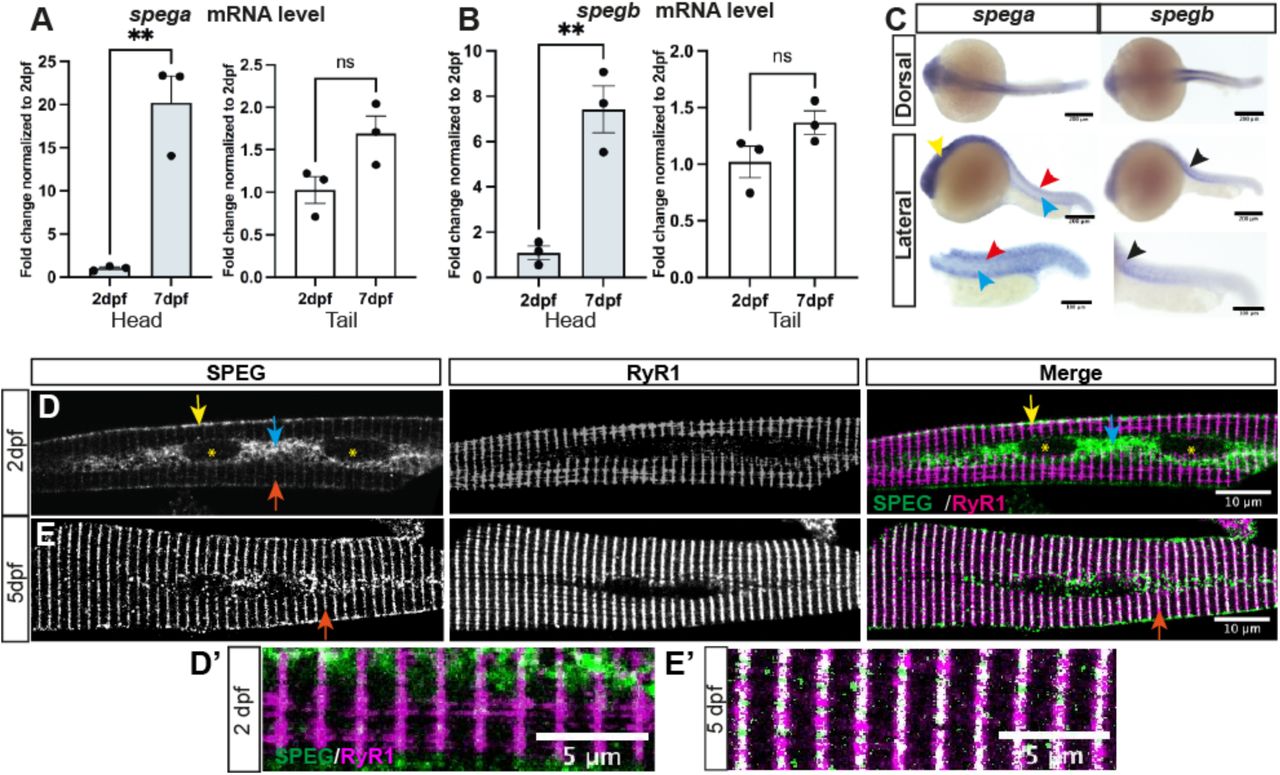 ... E ) isolated wildtype skeletal myofibres double-stained with anti-RyR1 (34C, DSHB) and anti-SPEG (PA553875, Invitrogen). ( D ... There are two SPEG genes in zebrafish, spega and spegb . Each encodes a single transcript that is highly conserved with human SPEG. ( A-B ) RT-qPCR shows similar temporal expression patterns of spega ( A ) vs spegb ( B ) from 2 dpf (day-post-fertilization) to 7 dpf. Both SPEG mRNA transcripts are significantly upregulated in the heads ( gray bars ; 20-fold for spega , and 7-fold for spegb ), but stay at relatively similar levels in the skeletal-muscle-predominant tails ( white bars ). Each data point represents the average of technical triplicates, and three independent experiments are included. Columns and error bars represent Mean ± SEM. Two-tailed Student’s t -test was performed: **, P <0.01; ns, not significant. ( C ) Wholemount in situ hybridization using DIG-conjugated RNA probes in 1 dpf embryos show distinct spatial expression patterns of spega vs spegb . spega is predominantly expressed in the developing brain ( yellow arrowhead ) and along the neural tube ( red arrowheads ), but absent from the notochord ( cyan arrowheads ). spegb staining, however, is predominantly detected at the chevron-shaped developing somites ( black arrowheads ). In situ images - scale bars : 200 μm (upper, middle) or 100 μm (bottom). ( D-E ) Average Z-projections of confocal images showing 2 dpf ( D ) or 5 dpf ( E ) isolated wildtype skeletal myofibres double-stained with anti-RyR1 (34C, DSHB) and anti-SPEG (PA553875, Invitrogen). ( D and D’ ) At 2 dpf, SPEG is predominantly localized at the sarcolemma ( yellow arrows ) and perinuclear regions ( cyan arrows ; nucleus: yellow asterisks ) with weak expression in transverse striations ( orange arrows ), whereas RyR1 is localized in transverse striations labeling the terminal sarcoplasmic reticulum (SR). Little co-localization ( white in Merge) of SPEG ( green ) and RyR1 ( magenta ) can be observed at this stage. ( E and E’ ) At 5 dpf, SPEG expression becomes restricted in the transverse striations ( orange arrows ) that overlap with RyR1. IF images - scale bars : 10 μm for D and E, 5 μm for D’ and E’.