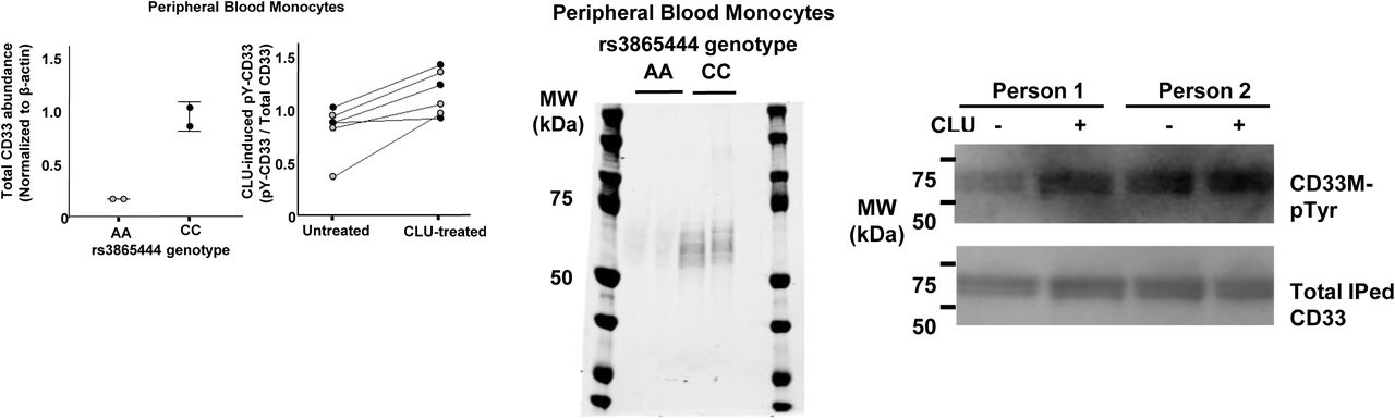 Treatment of Human monocytes with 0.06 µM CLU for 15 min at 37°C increases tyrosine phosphorylation of the ITIM domain on endogenous CD33M. Quantitative western blots of lysates for human blood monocytes reveal that monocytes from homozygous carriers of the rs3865444 AA reference /non-risk allele (gray dots) express less total CD33 and less CD33M than do homozygous carriers of the rs3865444 CC risk allele (black dots) ( Left panels ). Treatment of human monocytes with 0.06 µM CLU for 15 min at 37°C increases tyrosine phosphorylation of the ITIM domain on endogenous CD33M both in individuals homozygous for the rs3865444 CC risk allele (black dots) and in individuals homozygous for the rs3865444 AA reference /non-risk allele (gray dots) paired t-test, p=0.007 (2 nd left panel). NB: As demonstrated in the left panel, carriers of the rs3865444 CC risk allele express much more CD33M than do carriers of the rs3865444 AA reference allele. However, when equal quantities of CD33M protein are loaded onto these blots to facilitate comparison of basal and CLU-induced CD33 ITIM phosphorylation, the specific activity of CD33M signaling is the same. Representative Western blots for Supplemental Figure 5F. Treatment of Human monocytes with 0.06 µM CLU for 15 min at 37°C increases tyrosine phosphorylation of the ITIM domain on endogenous CD33M. Middle panel : Quantitative western blots of lysates for human blood monocytes reveal that monocytes from homozygous carriers of the rs3865444 AA reference express less total CD33 and less CD33M than do homozygous carriers of the rs3865444 CC risk allele. Right panel : Representative western blots showing that treatment of human monocytes with 0.06 µM CLU for 15 min at 37°C increases tyrosine phosphorylation of the ITIM domain on endogenous CD33M both in individuals homozygous for the rs3865444 CC risk allele (person 2) and in individuals homozygous for the rs3865444 AA reference /nonrisk allele (person 1). Representative western blots are available in Extended Data Figure 5C-G. NB: As demonstrated in the left panel, carriers of the rs3865444 CC risk allele express much more CD33M than do carriers of the rs3865444 AA reference allele. However, when equal quantities of CD33M protein are loaded (bottom right panel) onto these blots to facilitate comparison of basal and CLU-induced CD33 ITIM phosphorylation, the specific activity of CD33M signaling is the same. 