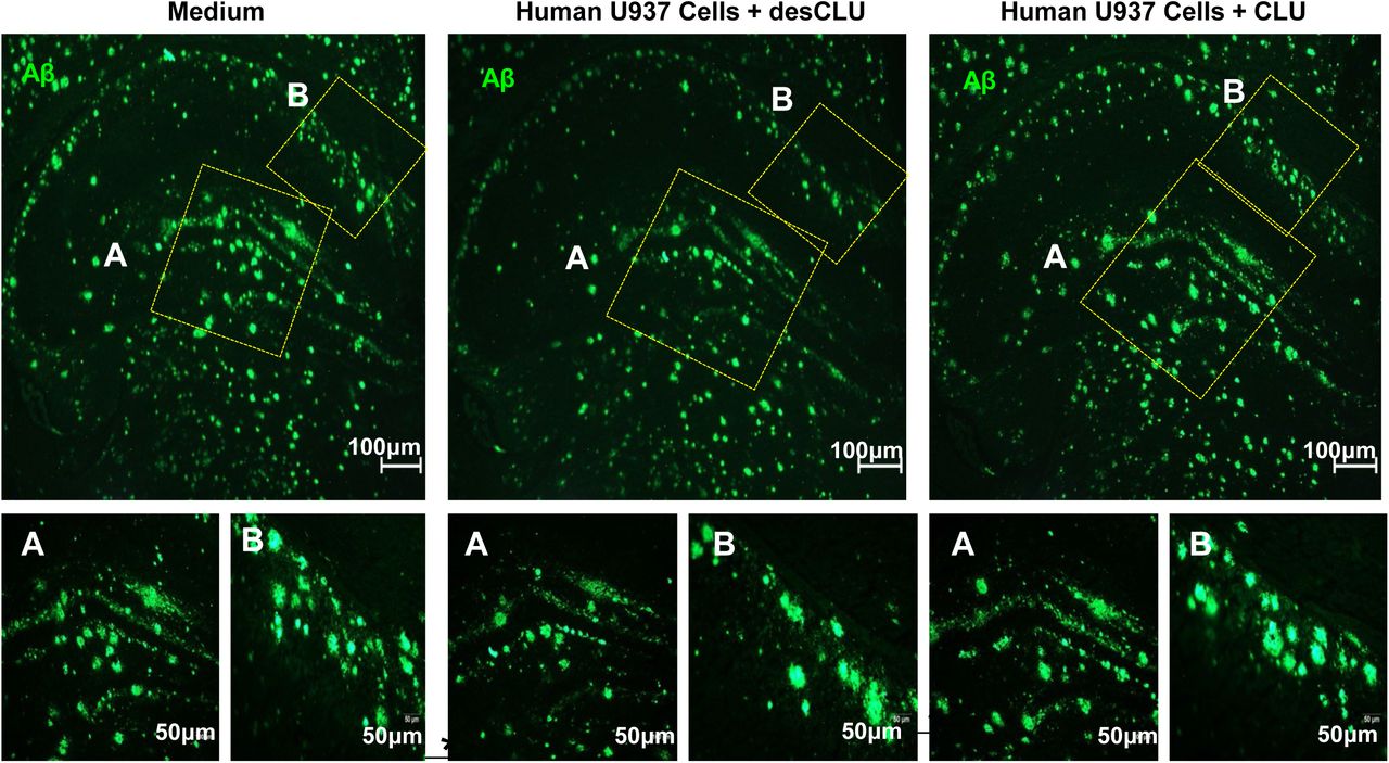 Compared to CLU, desCLU does not downregulate clearance of Aβ plaques by human U937 monocytic cells. Representative figures quantified in of clearance of hippocampal Aβ plaques (green) by U937 cells following incubation on serial sections of unfixed brain from 5XFAD mice in the presence of CLU or desCLU. Immunofluorescent staining of hippocampal Aβ plaques following 48h incubation with medium only but no cells ( left ) or with U937 cells + desCLU ( middle ) or with U937 cells + CLU ( right ). Small figure magnifications of regions of interest: A: x10; B: x20. Scale bars: 100 μm in I and A; and 50 μm in B. n = 10 replications 