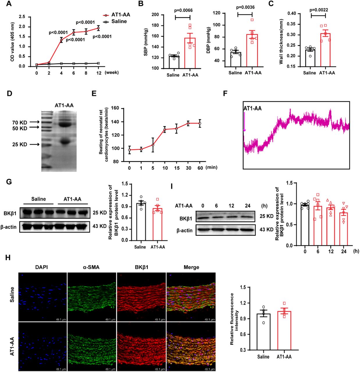 (A) 12 weeks after active immunization with AT1R-ECII, the OD value of serum AT1-AA in rats was detected. Detection of (B) caudal vein blood pressure and (C) vascular wall thickness of thoracic aorta in AT1-AA-positive rats, n=5. (D) The light and heavy chains of AT1-AA isolated by SDS-PAGE gel. (E) Effect of AT1-AA on the beating of neonatal rat cardiomyocytes. (F) The effect of AT1-AA on vasomotion was detected by vascular ring. Detection of <t>BKβ1</t> protein level in (G) thoracic aorta of AT1-AA-positive rats and (I) VSMCs treated with AT1-AA, n=5. (H) Detection of BKβ1 protein level in thoracic aorta of AT1-AA-positive rats by immunofluorescence method, n=4.