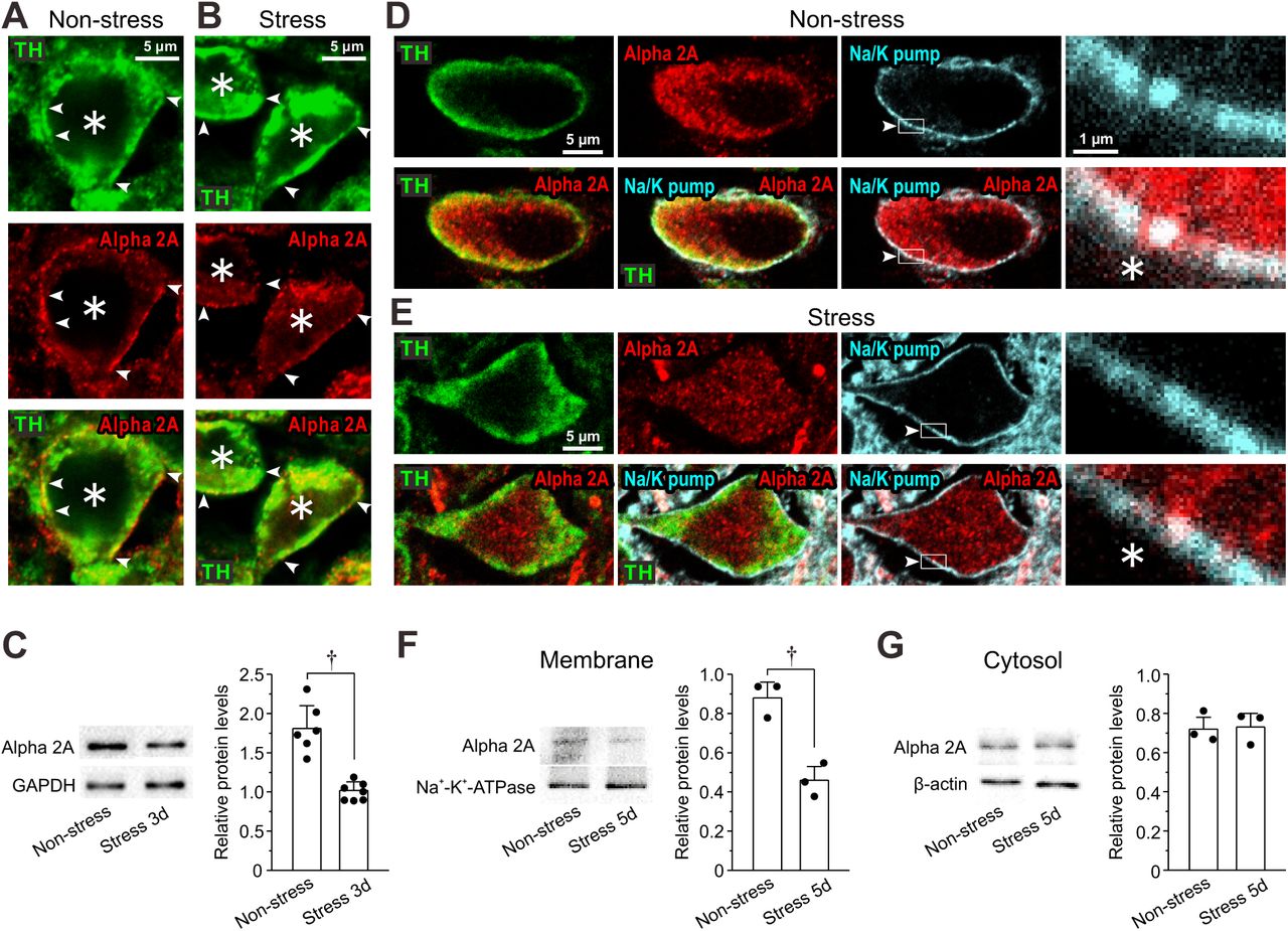 ( A, B ) Confocal images of LC neurons showing immunoreactivities for TH and <t>α2A-ARs,</t> together with a merged one in non-stress and 3-day RS mice. Arrowheads indicate the membrane regions of TH-positive neurons, along which α2A-ARs were differentially expressed between the control and the RS mice. Asterisks indicate LC neurons. ( C ) Western blotting analyses showing the expression of α2A-ARs in non-stress and 3-day RS mice ( n = 6 and 7, respectively). Unpaired t -test, † p < 0.001. ( D, E ) Confocal images of LC neurons in non-stress and RS mice. Upper panels from left to right showing the respective immunoreactivity for TH, α2A-ARs (with rabbit anti-α2A-AR) and Na + -K + -pump and an enlarged image of the region enclosed with a rectangle (arrowheads) in its immediate left panel. Lower panels from left to right showing the merged image of TH and α2A-ARs, that of TH, α2A-ARs and Na + -K + -pump, that of α2A-ARs and Na + -K + -pump and an enlarged image of the region enclosed with a rectangle in its immediate left panel. ( F, G ) Western blotting analyses showing expressions of α2A-ARs and Na + -K + -pump in membrane fraction and those of α2A-ARs and β-actin in cytosol fraction in non-stress and 5-day RS mice ( n = 3 and 3 samples, respectively). Each sample represents the analysis result in the LC tissues obtained from 2-3 mice. Membrane; unpaired t -test, † p = 0.016. Cytosol; unpaired t -test, † p = 0.083. 