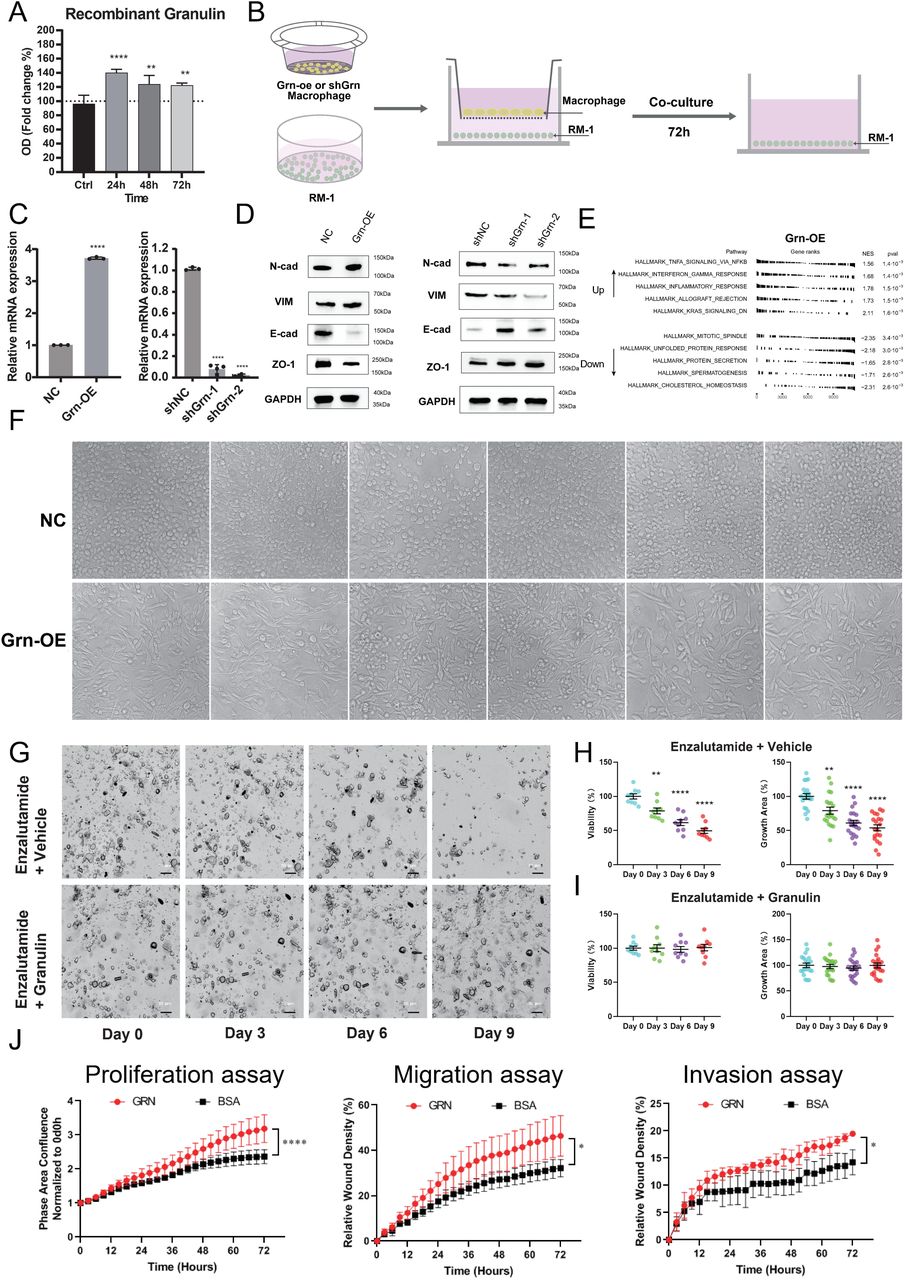 ( A ) Cell viability of RM-1 cells treated with indicated doses of recombinant granulin. Data measured using CCK8 assays. Data are expressed as the mean±SD, ** P <0.01, **** P <0.0001 by one-way ANOVA. ( B ) Schematic illustration of co-culture macrophage RAW264.7 cells with RM-1 cells. ( C ) Quantitative RT-PCR of overexpressing the GRN gene (left) or shRNA targeting Grn gene (right) in mouse macrophage RAW264.7. Bars represent fold change in mRNA levels relative to NC. Data are expressed as the mean±SD, ** P <0.01, **** P <0.0001 by one-way ANOVA. (D) Immunoblots of indicated EMT proteins in RM-1 cells post co-culture with RAW264.7 transfected with overexpressing the Grn gene (left) or shRNAs (right). (E) fGSEA analysis showing the up-regulated and down-regulated enriched pathways for RM-1 cells post co-culture with RAW264.7 with overexpressing the Grn. ranked by P-value. (F) Morphology of RM-1 cells post co-culture with RAW264.7 with overexpressing the Grn (n=6). ( G ) Representative images of <t>patient-derived</t> <t>prostate</t> cancer organoids after enzalutamide (80 μM) treatment with or without granulin (16.6 μg/mL). Scale bars: 50 μm. (H, I) Patient-derived prostate cancer organoid viability (n = 9 wells from 3 patients) and growth area (n = 20 fields from 3 patients) after enzalutamide (80 μM) treatment with (below) or without (above) granulin (16.6 μg/mL). Viability was measured using CCK8 assay. Growth area was measured using high-content assay. Date are mean±s.d, ** P <0.01, **** P <0.0001 by one-way ANOVA. ( J ) Live-cell imaging assay of <t>LNCaP</t> cells with or without recombinant human granulin protein to measure cell growth, migration and invasion over 3 days. Date are mean±s.d, ** P <0.01, **** P <0.0001 by two-way ANOVA. 
