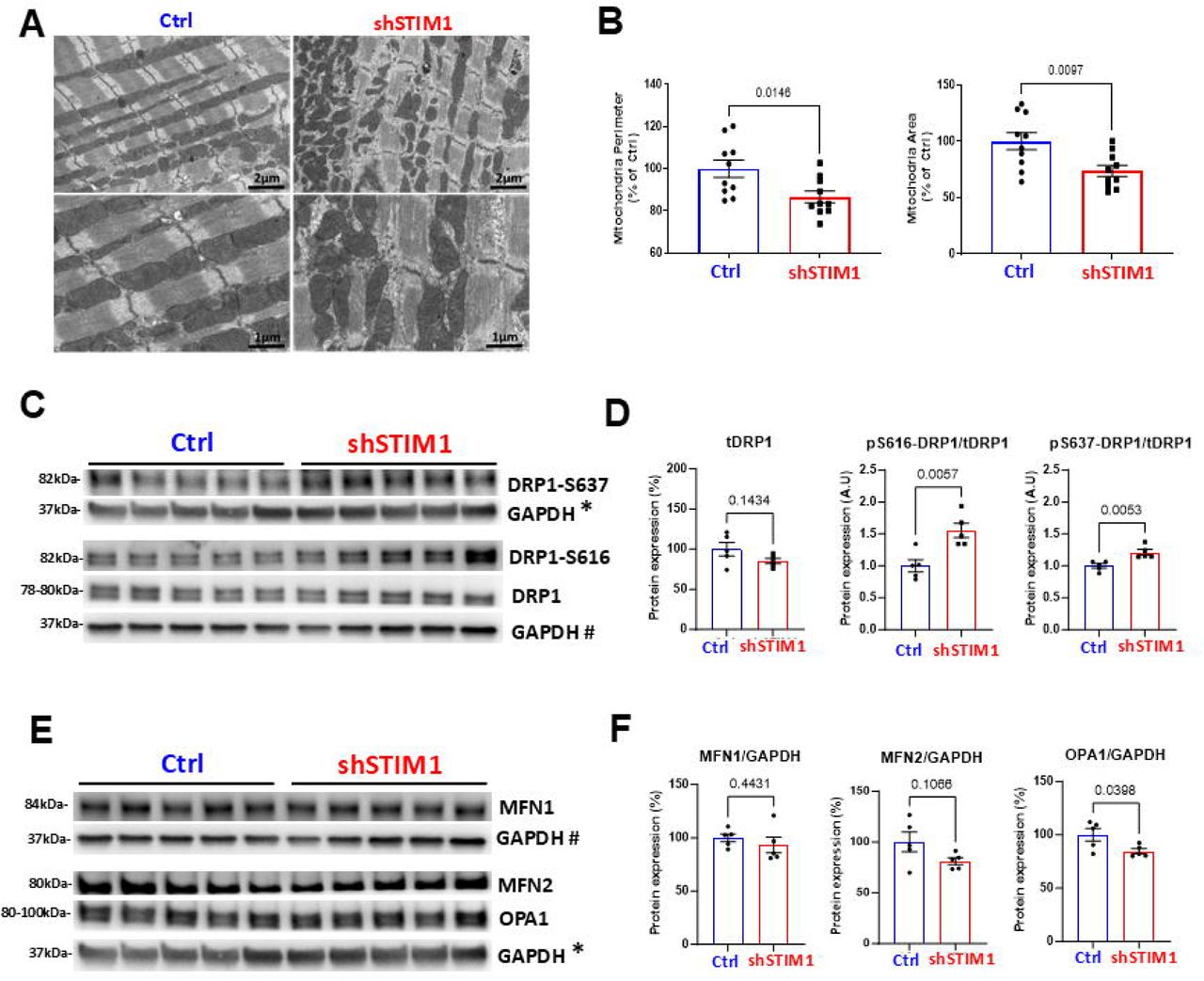 A. Transmission electron microscopy images from the left ventricles of Ctrl and shSTIM1 hearts 4 weeks post gene transfer showing differences in mitochondrial network ultrastructure and morphology. B . Mitochondrial dimensions (perimeters and areas) were quantified. C-D . Representative immunoblots and densitometric quantifications of total and phosphorylated DRP1 at Ser 637 and Ser 616 in tissue lysates from Ctrl and shSTIM1 hearts, 4 weeks post gene transfer. DRP1 protein levels were normalized to GAPDH and pDRP1 proteins were normalized to total DRP1 levels. shSTIM1 hearts showed a 55% and 21% increase in pS616/tDRP1 ratio (1.55±0.11 vs 1±0.09 in Ctrl) and p637/tDRP1 ratio (1.21±0.04 vs 1±0.03 in Ctrl), respectively versus Ctrl hearts. N=5 hearts per group was used. E-F . Representative immunoblots and densitometric quantifications of the major mitochondrial fission/fusion proteins, Mitofusin-1 (MFN1), <t>Mitofusin-2</t> <t>(MFN2)</t> and OPA1 normalized to GAPDH in lysates from Ctrl and shSTIM1 hearts 4 weeks post gene transfer. While MFN1 and MFN2 protein levels were unchanged, OPA1 was decreased by 15.4% (84.6±2.4% vs 100±5.8% in Ctrl hearts). N=5 hearts per group. Statistics: t-test. GAPDH* and GAPDH# mean that the same GAPDH blot was used to normalize the expression of multiple proteins (as indicated in Panels C and E) after stripping the membrane and blotting for those proteins. 