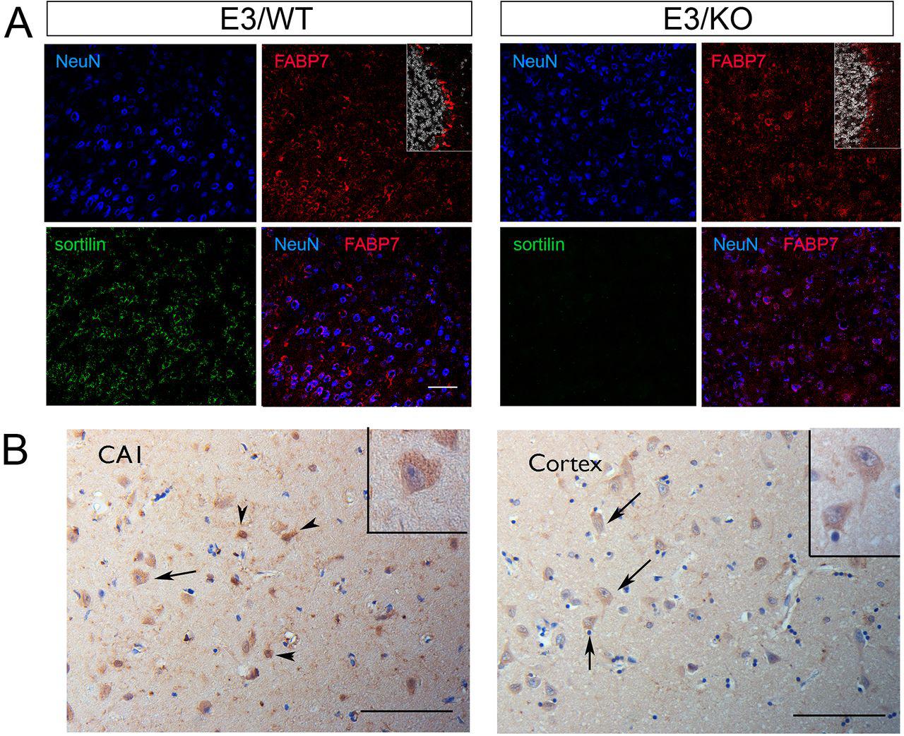 ( A ) Immunohistological detection of FABP7 (red) in brain cortical sections from apoE3 mice, either wild-type (WT) or genetically deficient for Sort1 (KO). Additionally, the sections were stained for the neuronal marker NeuN (blue) and sortilin (green) as well as DAPI (white; in insets). Merged images show co-expression of FABP7 with NeuN. As a positive control, the insets document expression of FABP7 in glia in the cerebellum of E3/WT and E3/KO mice. Representative images from analysis of 3 mice per genotype are shown. Scale bar:100 μm. ( B ) Staining for FABP7 in hippocampal subfield CA1 and temporal cortex specimens of AD patients, showing immunoreactivity in glial cells (arrowheads) and light positivity in sparse neuronal cells (arrows, and insets). Representative images from one of three AD cases analyzed are shown (pathological characteristics given in ). Scale bars: 100 μm and 50 μm (inset).
