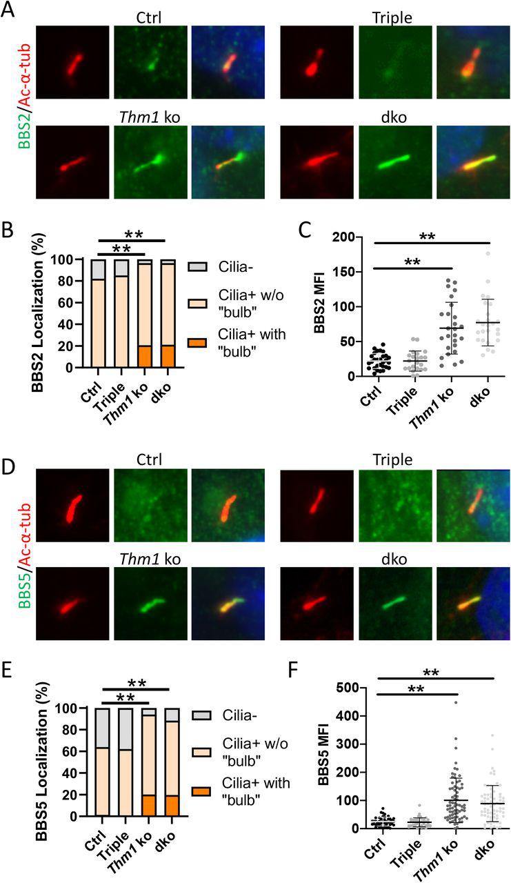 (A) Immunostaining for <t>BBS2</t> (green) and ac-α-tubulin (red). (B) Quantification of BBS2 ciliary localization. Total number of Ctrl, Triple, Thm1 ko and dko cells quantified were 183, 167, 334 and 223, respectively, from 2-3 independent experiments. Statistical significance was determined by χ 2 test. (C) Fluorescence intensity of BBS2 in cilia. Each dot represents an individual cilium. Bars represent mean ± SD. Statistical significance was determined by ANOVA followed by Tukey’s test. (D) Immunostaining for BBS5 (green) and ac-α-tubulin (red). (E) Quantification of BBS5 ciliary localization. Total number of Ctrl, Triple, Thm1 ko and dko cells quantified were 219, 261, 229 and 217, respectively, from 3 independent experiments. Statistical significance was determined by χ 2 test. (E) Fluorescence intensity of BBS5 in cilia. Each dot represents an individual cilium. Bars represent mean ± SD. Statistical significance was determined by ANOVA followed by Tukey’s test. **p<0.0001 