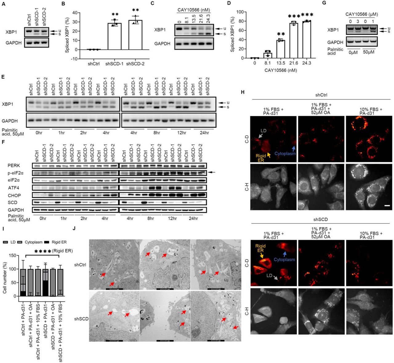 (A) XBP1 splicing (u, unspliced transcript; s, spliced transcript) measured by RT-PCR and agarose-gel electrophoresis in OVCAR-5 cells transduced with control shRNA (shCtrl) or shRNAs (1 or 2) targeting SCD (shSCD) and cultured in low serum conditions (1% FBS) for 48 hours. (B) Densitometric analysis of XBP1 splicing products shown in A. Bars represent percent of spliced XBP1 relative to total XBP1 (mean ± SD, n = 3). (C) XBP1 splicing (u, unspliced transcript; s, spliced transcript) in OVCAR-5 cells cultured in low serum conditions and treated with SCD inhibitor <t>CAY10566</t> for 48 hours. (D) Percent of spliced XBP1 isoform measured by densitometric analysis of PCR products shown in C (mean ± SD, n = 3). (E, F) XBP1 splicing (u, unspliced transcript; s, spliced transcript) (E), and western blot of proteins of the PERK/eIF2α/ATF4 axis (F) in shCtrl and shSCD OVCAR-5 cells cultured under low serum conditions and treated with 50μM palmitic acid for the time periods indicated. (G) XBP1 splicing (u, unspliced transcript; s, spliced transcript) in primary cells from tumors of ovarian cancer patients cultured in low serum conditions and treated with 3μM CAY10566 for 48 hours, or with 1μM CAY10566 and 50μM palmitic acid for 12 hours. (H) Representative SRS images in the C-H and C-D regions of OVCAR-5 shCtrl and shSCD cells cultured in low serum conditions (1% FBS) and treated with 12.5μM palmitic acid-d31 (PA-d31), with or without 52μM oleic acid (OA), or cultured in medium with full serum (10% FBS) and treated with PA-d31 for 24 hr. Yellow arrows indicate rigid ER, gray arrows indicate lipid droplet (LD), and blue arrows indicate cytoplasm. Scale bar: 20 µm. (I) Percentages of shCtrl and shSCD OVCAR-5 cells treated as described in (H) showing C-D SRS signal mainly in rigid ER, lipid droplet (LD), and cytoplasm (n = 139-191). (J) Transmission electron microscopy imaging of smooth ER (red arrows) in OVCAR-5 shCtrl vs shSCD cells cultured in low serum conditions for 48 hours. * p < 0.05, ** p < 0.01, *** p < 0.001, **** p < 0.0001.