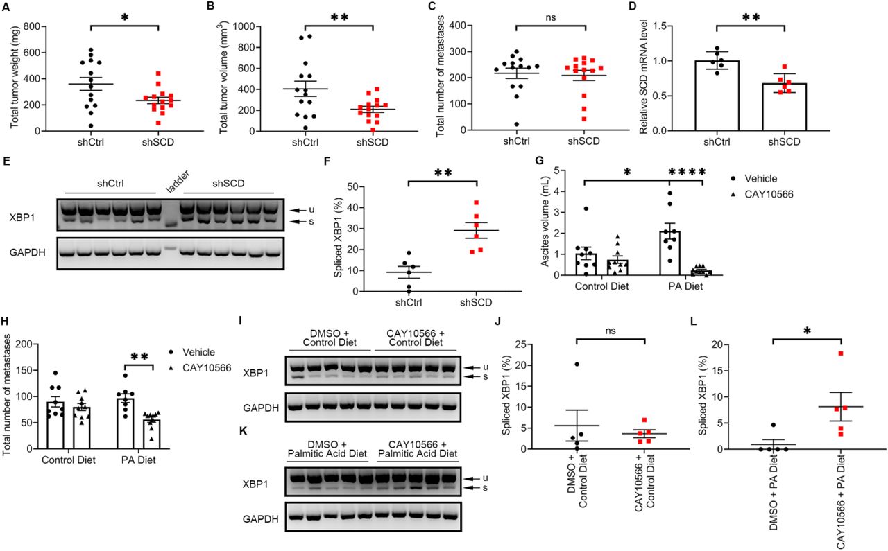 ... or control diet, and treated with SCD inhibitor CAY10566 or vehicle for 28 days. Values are means ... (A-C) Total tumor weight (A), total tumor volume (B) and total number of metastases (C) in athymic nude mice intraperitoneally injected with OVCAR-5 cells transduced with control shRNA (shCtrl) or shRNA targeting SCD (shSCD), and evaluated after 28 days (values are means ± SE, n = 14 per group). (D) qRT-PCR measurements of SCD expression (mean ± SD, n = 6) in a random sample of tumor xenografts described in (A). (E, F) Agarose gel electrophoresis of XBP1 splicing products (u, unspliced transcript; s, spliced transcript) (E), and percent spliced XBP1 isoform estimated by image analysis of transcript bands (mean ± SD, n = 6) (F) in a random sample of tumor xenografts described in (A). (G, H) Ascites volume (G) and total number of metastases (H) in athymic nude mice intraperitoneally injected with OVCAR-5 cells, fed with a palmitic acid-rich diet or control diet, and treated with SCD inhibitor CAY10566 or vehicle for 28 days. Values are means ± SE, n = 10. (I-L) XBP1 splicing products (u, unspliced transcript; s, spliced transcript) (I, K), and percent intensity of the spliced transcript estimated by image analysis (J, L) in a random sample (n = 5) of tumor xenografts described in (F). Values are means ± SD. * p < 0.05, ** p < 0.01, *** p < 0.001, **** p < 0.0001.