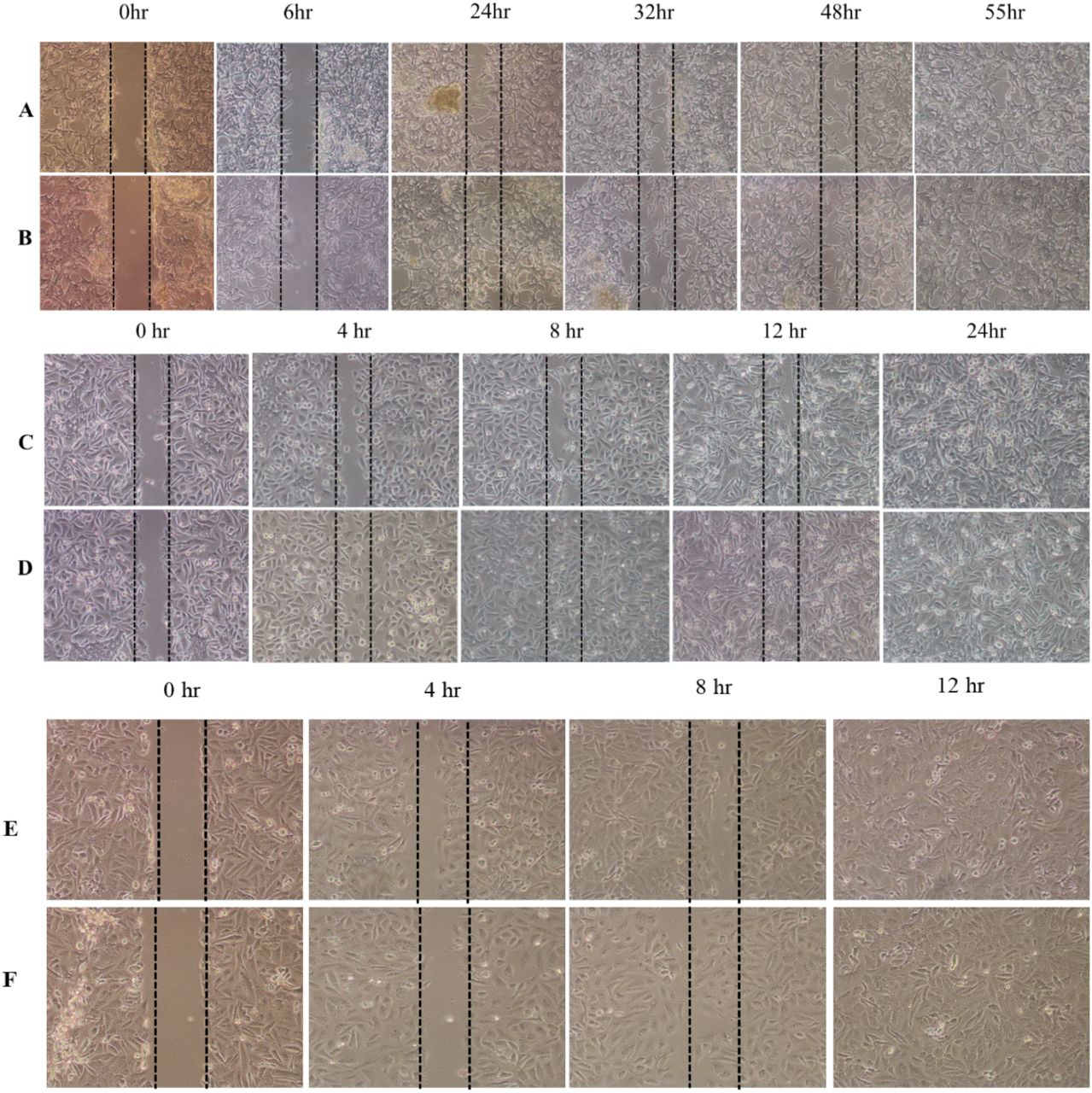 A total of 4X10 6 cells/dish were plated either on plain or collagen-coated surfaces and allowed to grow until they reached the required confluency. A wound was created using a 200 µL micropipette tip. Images were captured post-wound to monitor cell migration. Scale bar: 100mm. A: <t>LNCaP</t> cells cultured on a plain surface. B: LNCaP cells cultured on a collagen-coated surface. <t>C:</t> <t>DU145</t> cells cultured on a plain surface. D: DU145 cells cultured on a collagen-coated surface. E: PC3 cells cultured on a plain surface F: PC3 cells cultured on a collagen-coated surface 