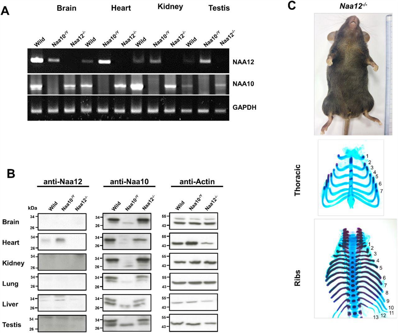 (A) Expression of Naa10 and Naa12 in WT, Naa10 KO and Naa12 ... (A) Expression of Naa10 and Naa12 in WT, Naa10 KO and Naa12 KO tissues, adult mice 13 weeks of age, (brain, heart, kidney and testis) by RT-PCR. Expression of GAPDH was analyzed as an endogenous control. (B) Phenotypes in Naa12 KO mice. Lack of hypopigmentation (upper; N=29) and lack of supernumerary ribs (middle and bottom; E18.5; N=7) in Naa12 KO mouse.