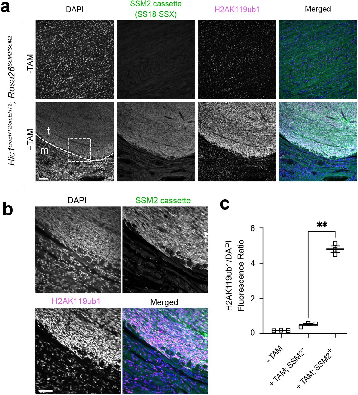 ... to dashed line in (a). c) Quantification of H2AK119ub signal intensity normalised to DAPI signal intensity in ... a) Immunofluorescence of Hic1 creERT2/creERT2 ; Rosa26 SSM2/SSM2 mice at 16-week endpoint tongue tissue showing left, samples from control mice not treated with tamoxifen (-TAM) (upper panel) or from tamoxifen treated (+TAM) mice expressing the SSM2 cassette (human SS18-SSX2) embedded in striated muscle (lower panel). The cells are stained for DAPI, SSM2 and H2AK119ub1. The scale bar represents 100 μm. b) Close-ups of images shown in the panel above, area corresponds to dashed line in (a). c) Quantification of H2AK119ub signal intensity normalised to DAPI signal intensity in 3 biological replicates in -TAM control mice, or +TAM tongue muscle or adjacent tumours (SSM2 negative or positive respectively). Asterisks represent p-values of paired one-tailed t-test between groups (** p< 0.01).