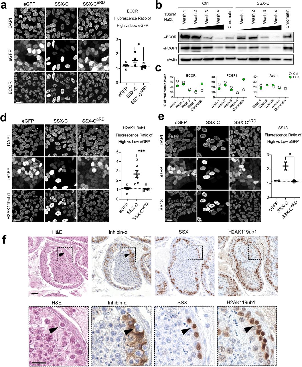 ... HS-SY-II synovial sarcoma cells expressing eGFP-fused constructs (eGFP, eGFP-SSX-C and eGFP-SSX-C ΔRD ). Right, quantification of BCOR ... a) Left, Immunofluorescence against BCOR in HS-SY-II synovial sarcoma cells expressing eGFP-fused constructs (eGFP, eGFP-SSX-C and eGFP-SSX-C ΔRD ). Right, quantification of BCOR fluorescence ratio in high versus low eGFP cells in 5 biological replicates. Data represents the mean and the S.E.M. Asterisks represent p-values of paired one-tailed t-test between groups (* p< 0.05). Scale bars correspond to 20μm. b) Sequential chromatin washes assay using 150mM salt buffer in untransduced control (Ctrl) or eGFP-SSX-C expressing HEK293T cells. BCOR, PCGF1 or Beta-Actin as a loading control were detected by western blot. c) Quantification of the protein distribution for BCOR, PCGF1 or Beta-Actin in the various washes. Data represents the percentage of total protein levels. d) Left, Immunofluorescence against H2AK119ub1 in HS-SY-II cells expressing the indicated eGFP-fused constructs. Right, quantification of H2AK119ub1 fluorescence ratio in high versus low eGFP cells in 7 biological replicates. Data represents the mean and the S.E.M. Asterisks represent p-values of paired one-tailed t-test between groups (*** p< 0.001). Scale bars represents 20μm. e) Left, Immunofluorescence against SS18 in HS-SY-II cells expressing the indicated eGFP-fused constructs. Right, quantification of the SS18 fluorescence ratio in high versus low eGFP cells in 2 biological replicates. Data represents the mean and the standard error of the mean (S.E.M). Asterisks represent p-values of paired one-tailed t-test between groups (* p< 0.05). Scale bars correspond to 20μm. f) H&E and immunohistochemical staining for Inhibin-a, SSX and H2AK119ub1 in human testis. Scale bar correspond to 40μm in the upper panel. Lower panel is a close-up from the images shown in the upper panel (area marked by a dashed line) where the scale bar corresponds to 20μm.