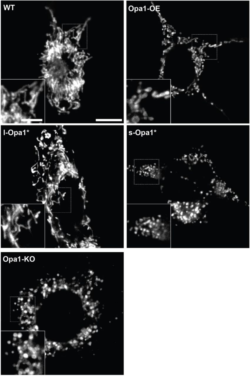 Representative images of mitochondrial morphology in indicated MEF cell lines labeled with MitoTracker TM Deep Red ... Representative images of mitochondrial morphology in indicated MEF cell lines labeled with MitoTracker TM Deep Red FM. Insets show magnified view of regions indicated with dashed boxes. Scale bar = 10 µm. Inset scale bar = 5 µm.
