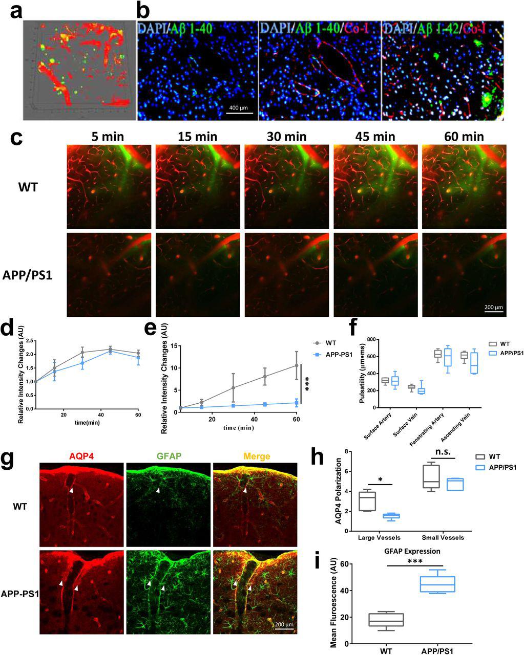 ... was observed (d). (h-i) Expression of AQP4 and GFAP in cortex and hippocampus. Compared with WT control ... Impairment of glymphatic clearance and deposition of Aβ plaques in APP-PS1 mice. (a) In vivo imaging of Aβ deposition in the cerebral cortex (FSB: green). Aβ deposition was evident in the parenchyma with no distinct CAA. (b) Immunology of Aβ 1–40 and Aβ 1–42 in APP-PS1. Significant numbers of Aβ 1–42-labeled amyloid plaques were observed in the parenchyma, but no marked deposition of Aβ 1–40. (c) Representative images of paravascular CSF tracer clearance at 100 μm below the cortical surface in APP-PS1 indicating severe impairment in penetration of fluorescence tracer (e) while no changes in paravascular movement was observed (d). (h-i) Expression of AQP4 and GFAP in cortex and hippocampus. Compared with WT control mice, APP-PS1 mice displayed significant decrease in AQP4 polarization and exhibited a marked increase in GFAP expression in the cortex (n=6 mice per group). No significant pulsatility changes were observed between APP-PS1 and WT control mice (f) (n=7-8 vessels per group).