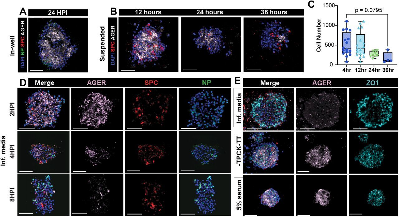 (A) Treatment of AEOs with IAV in media placed on apical surface of transwell above matrigel plug. Minimal NP expression is evident at 24hpi. (B) Morphology of AEOs in suspension culture after liberation from Matrigel. AT1 and <t>AT2</t> cell morphology is maintained for 24h post-suspension but has decreased by 36h. (C). Cell number per organoid in suspension culture. We noted a nearly significant loss of cell number by 36h post liberation. (D) Cell state of AEOs with infection of IAV using SAGM base media with TPCK-treated trypsin and lacking serum (Inf. media). Suspension in this medium allowed flu infection by 8h (NP) but led to loss of AT1 cells (AGER) without loss of AT2 cells (SPC). (E) Impact of different media compositions on cell junctions in AEOs. Infection media (top row) led to loss of AGER and associated loss of ZO-1 marked cell surface tight junctions. Removal of TPCK-treated trypsin or addition of 5% serum prevented these changes. Scale bars = 50 μm. (SPC = Surfactant Protein C [AT2 marker]; Ager = Advance Glycosylation End-product Specific Receptor [AT1 marker]; NP = IAV nucleoprotein [infected cell marker], ZO-1 = Zonula Occludens-1 [cell surfact tight junction marker]) . 
