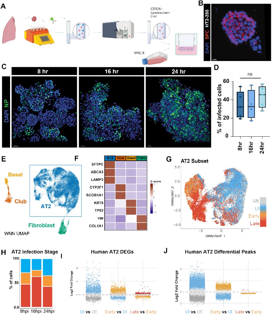 (A) Schematic describing the co-culture of freshly sorted human epithelial cells with MRC5 fibroblasts for creation of human AEOs. (B) IHC demonstrating clear punctate SPC expression in human AEOs; we noted relatively low level HT2-280 expression in established AEO culture. (C-D) Dynamics of PR8 IAV infection in AEOs, showing high levels of nuclear NP expression (C) which is quantified in (D). (E-F) UMAP projection (EF) and cell marker gene expression (F) of cell states found in human AEOs. (G-H) UMAP of AT2 cell subset (G) and quantification (H) showing imputed flu infection state as previously described for murine organoids. (I-J) Strip plots showing differentially expressed genes (I) or differentially accessible chromatin regions (J) in Uninfected vs Unexposed, Early Infected vs Uninfected, and Late Infected versus Early Infected human AT2 cells. 