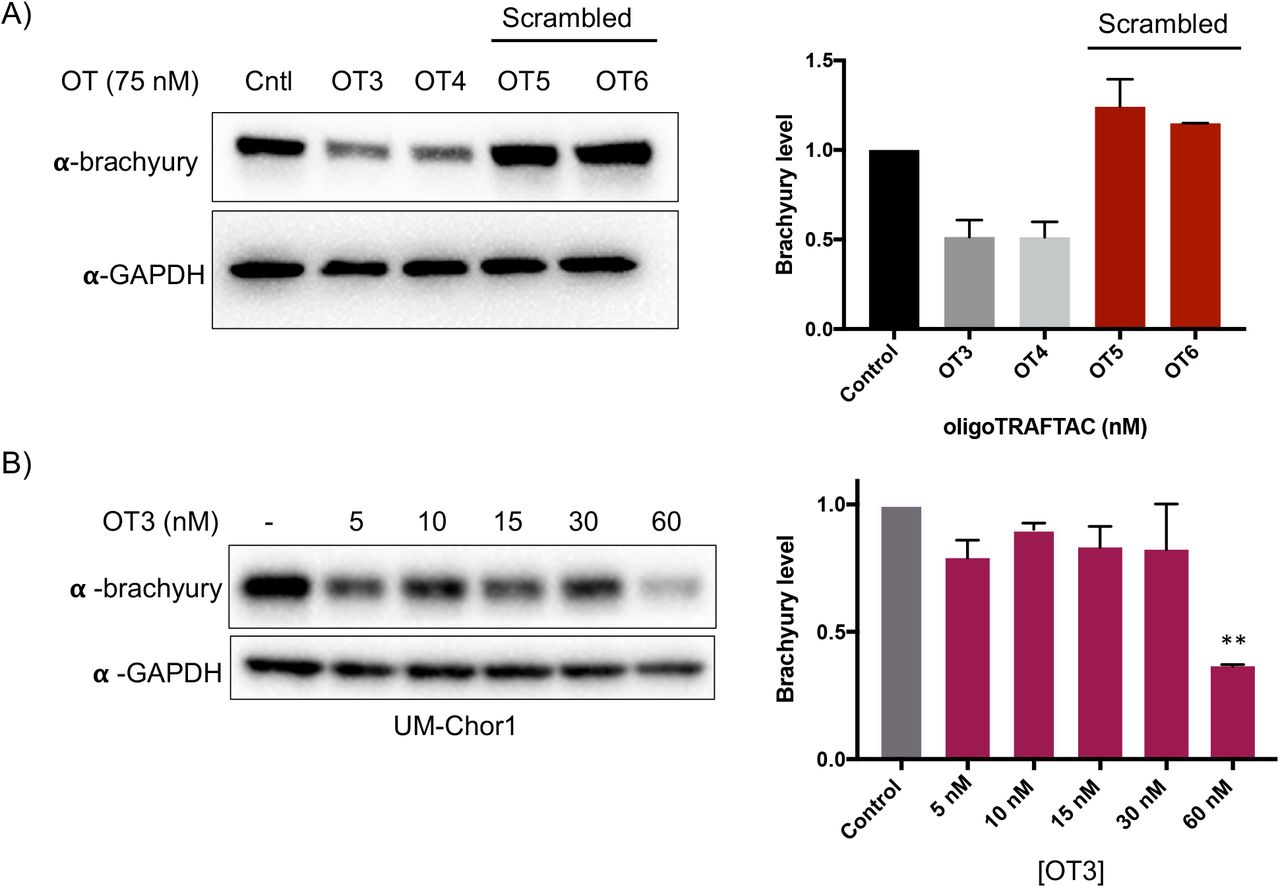 A) Brachyury-GFP degradation by OTs is sequence dependent. OT3, OT4, ... A) Brachyury-GFP degradation by OTs is sequence dependent. OT3, OT4, and their scrambled OTs (OT5 and OT6) were transfected and lysed after 20 h. Cell lysates were subjected to SDS-PAGE and western blotting. Blots were probed with brachyury and GAPDH antibodies. Quantitation of western blot bands is shown on the right. B) Increasing concentration of OT3 were transfected into UM-Chor1 cells and degradation was evaluated after 24 h.