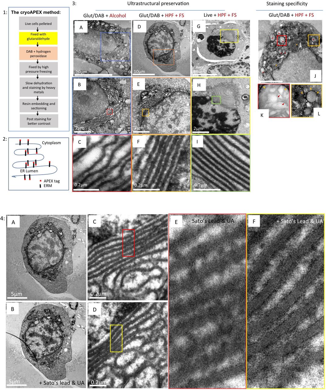 1) Flowchart describing cryoAPEX. 2) Schematic of APEX-tagged ERM expressed on the cytosolic face of the ER membrane. 3) The reorganized ER morphology in chemically fixed, DAB reacted ERM-APEX2 expressing cells that were processed via traditional chemical fixation/alcohol dehydration (A-C) or by cryoAPEX (D-F) was compared to ERM-APEX2 expressing cells that were cryofixed live and without the DAB reaction (G-I). The live cryofixed cells (G-I) represent the best attainable ultrastructural preservation and serve here as the metric for evaluating membrane preservation obtained via the two APEX based detection protocols (A-F). The high specificity of staining obtained by cryoAPEX is exemplified in images J-L. Here, thin section images of cells expressing ERM-APEX2 processed by cryoAPEX show preferential staining of the reorganized ER (J, orange asterisk) and the outer mitochondrial membrane (red asterisk in J and orange arrow heads in K-L, respectively) but not of the mitochondrial cristae (K, red arrow heads). 4) Post staining with heavy metals improves definition of preferentially stained membranes. Post-staining of thin sections with heavy metals using uranyl acetate and Sato’s lead solution following cryoAPEX provides additional contrast, thereby improving resolution. Shown are thin sections of the same cell imaged in before (A, C, and E) and after (B, D, and F) post-staining. Comparison of panels E and F clearly shows improved definition and the resolution of membranes at high magnifications in post-stained samples (F). UA = uranyl acetate.