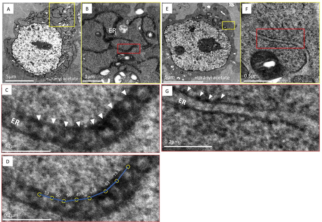 (A) An image of a thin section of HEK-293T cells expressing HYPE-APEX2 and processed by cryoAPEX reveal staining of the ER tubules in a well preserved (dense) cytoplasmic background. (B and C) Higher magnification images of a small section of the peripheral ER (demarcated by yellow box in A) exhibits periodic foci of APEX2 generated density (B, red box and C, white arrow heads showing periodicity between the HYPE foci). (D) Center-to-center density measurements showing the distance (in nm) between the HYPE-specific foci. (E) Untransfected control cells processed in an identical manner show the lack of APEX2 generated density within the ER lumen. (F and G) A higher magnification image of E (demarcated by yellow box) clearly shows the lack of density on the lumenal face (F, and magnified image of the ER section within red box in G). Additionally, density corresponding to ribosomes on the cytoplasmic face of the ER membrane is evident (G, white arrowheads). Thus, HYPE is detected only along the lumenal face of the ER membrane and never on the cytosolic face.