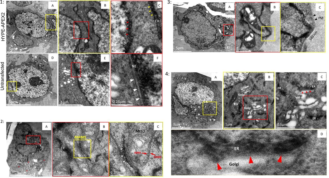 1) Localization of HYPE to the nuclear envelope (NE): Images of thin sections from cells transfected with HYPE-APEX2 and processed by cryoAPEX show HYPE specific density within the perinuclear space of the nuclear envelope (A-C). At higher magnification, this staining shows a pattern similar to that seen along the lumenal face of the ER membrane (C; compare red and yellow arrowheads within the NE and the ER, respectively). Untransfected cells processed in this manner exhibit no membrane associated staining within the perinuclear space of the nuclear envelope (D-F and white arrowheads in F). 2) HYPE does not localize to the mitochondria: Cells transfected with HYPE-APEX2 were processed by cryoAPEX in the presence of osmium tetroxide but without addition of uranyl acetate or tannic acid. Thin sections of these cells showed a distinct lack of mitochondrial membrane staining, making it difficult to visualize mitochondria at low magnifications (red asterisks in A). Magnified images of well-preserved ER-mitochondrial junctions (MAMS; demarcated by red box in A) clearly show ER tubules in close contact with two adjacent mitochondria (B). A further magnified image of the MAMS shows the HYPE-APEX2 staining of the ER but no apparent staining within the inner or outer mitochondrial membranes (B, yellow box; and C, magnified image of the area within this yellow box). The periodic distribution of HYPE is retaied even at the MAMS (C, white arrow heads). ER = endoplasmic reticulum. MITO = mitochondrion. IMM = inner mitochondrial membrane. OMM = outer mitochondrial membrane. MAMS = mitochondria associated membranes. 3) HYPE does not localize to the Plasma Membrane (PM): Images of a cell expressing HYPE-APEX2 reveal absence of plasma membrane staining (A). Images of ER-PM junctions at high magnifications show well preserved junctions where the ER makes extended contacts with the plasma membrane (red box in A; yellow box in B; white bar in C). Staining was contained within the cortical ER tubules with no apparent staining of the plasma membrane (C, black arrowheads) 4) HYPE does not enter the secretory pathway: To assess whether HYPE enters the secretory pathway, the Golgi apparatus was imaged (A-D). Images from thin sections of HYPE-APEX2 transfected cells show an area where ER tubules are interspersed within Golgi stacks (A; region within yellow box). Higher magnification of this region shows the typical stacked morphology of the Golgi apparatus devoid of any osmicated DAB density within its lumen (B and C). Further magnification of a well-preserved ER-Golgi junction shows a region of extensive contact between the two organelles where the DAB density was restricted to the ER lumen and showed no apparent staining of the Golgi apparatus (B, area within red box. Red arrows in C and D indicate the ER-Golgi junction).