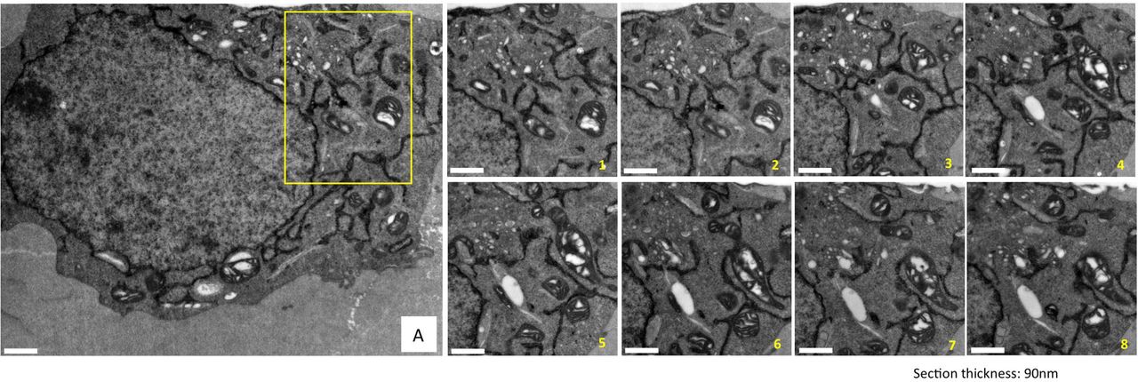 To demonstrate the consistency of the membrane ultrastructure preservation obtained by cryoAPEX, cells expressing HYPE-APEX2 were serially sectioned and a specific area (panel A, yellow box) was imaged. Multiple such ribbons containing between 10 and 20 serial sections of 90nm thickness were collected, screened and imaged. Representative images of 8 serial sections showing ER localization of HYPE are presented (images serially numbered 1 though 8). Sections exhibit a dense well-preserved cytoplasm with undisrupted membrane ultrastructure of organelles like mitochondria and Golgi complex in close proximity to the ER tubules containing HYPE-APEX2 density. Thus, we can follow HYPE localization through the volume of the cell without loss of contextual information.