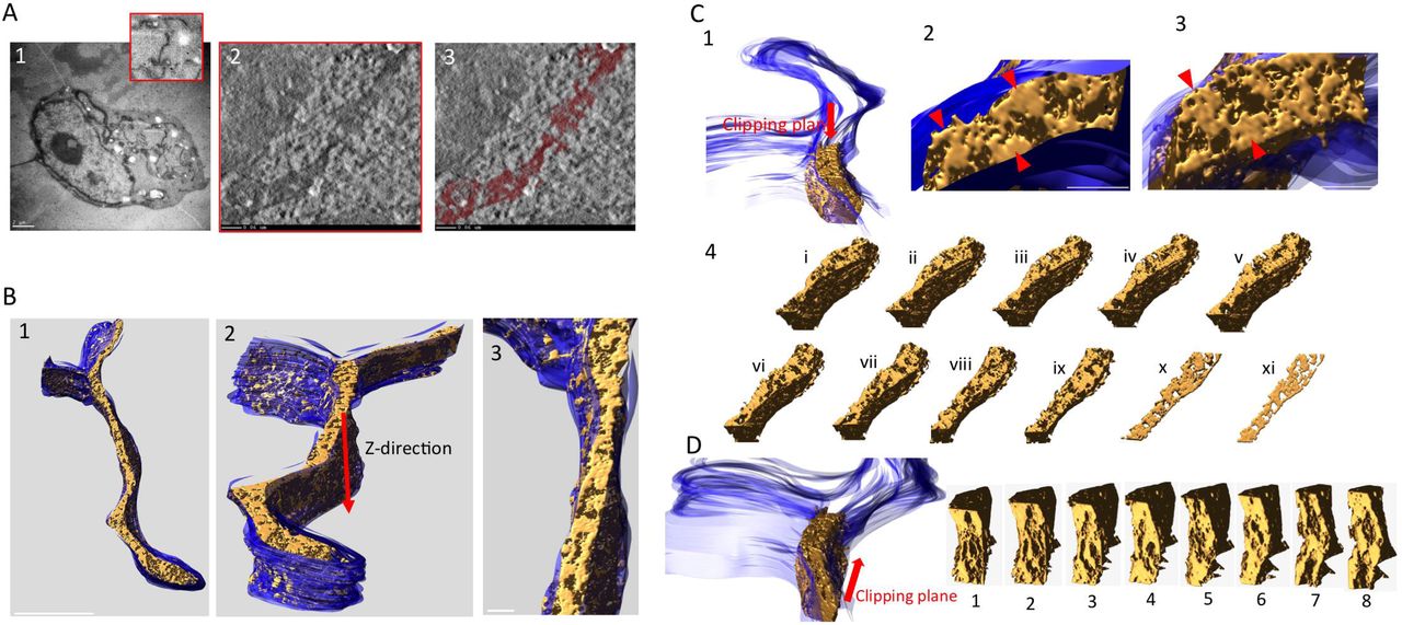 Tilt-series from HEK-293T cells expressing HYPE-APEX2 and processed by cryoAPEX were collected for 3D reconstruction of HYPE specific density. A) An image of the whole HYPE-APEX2 expressing cell showing an area containing ER tubules from where the tilt-series was collected (A1 and magnified red box). A2) Snapshot from the movie (see supplemental data, Figure S6 - movie 1) showing the reconstructed tomogram of HYPE density within the ER lumen. A3) Snapshot from the movie (see supplemental data, Figure S6 - movie 2) showing the reconstructed tomogram of the thresholded HYPE density (in maroon). B) An additional view of the 3D model of the ER membrane (blue) and the HYPE density within (gold) generated and visualized with the IMOD “Isosurface” tool (B1 through B3). C) Snapshots of a segment of the ER showing the HYPE-APEX2 density (gold) modeled within the lumen of the ER membrane (blue) visualized from the top of the indicated clipping plane (C1 through C3). Magnified images of different regions within this segment show HYPE’s periodic density pattern along the lumenal walls (C2, red arrow heads). Another view exposing the full face of the density (gold) using visualization tools that make the membrane transparent are also shown (C3, red arrow heads). This pattern of HYPE specific density is more apparent when the clipping plane is moved downward in the Z-direction progressively shaving through the depths of the different layers (C4, slices i through xi), and is most apparent when visualized in the thinnest slice (slice xi). D) A clipping plane that moves in a head to tail direction shows HYPE’s density pattern on the ER membrane from a front-on perspective (slices 1 through 8).