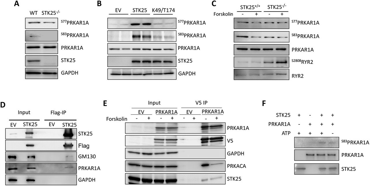 A) Immunoblot of PRKAR1A phosphorylation sites S77 and S83 in STK25 +/+ and STK25 -/- cardiomyocyte protein lysates. B) Immunoblots of phosphorylation sites S77 and S83 of PRKAR1A in STK25 -/- cardiomyocytes transfected with empty vector (EV), wild type STK25 and kinase dead K49R/T174A (loaded in duplicate). C) Forskolin (10μM) stimulated STK25 +/+ and STK25 -/- cardiomyocytes immunoblotted for phosphorylation of PRKAR1A and RYR2. D) Immunoprecipitation of Flag-STK25 expressed in HEK293T cells and immunoblotted for PRKAR1A and GM130 (positive control binding partner). E) Co-immunoprecipitation of PRKAR1A-V5 with STK25 and PRKACA in HEK293T cells treated with forskolin (10μM). F) In vitro kinase assay of purified STK25 and PRKAR1A, immunoblotted for phosphorylation of S83 of PRKAR1A.