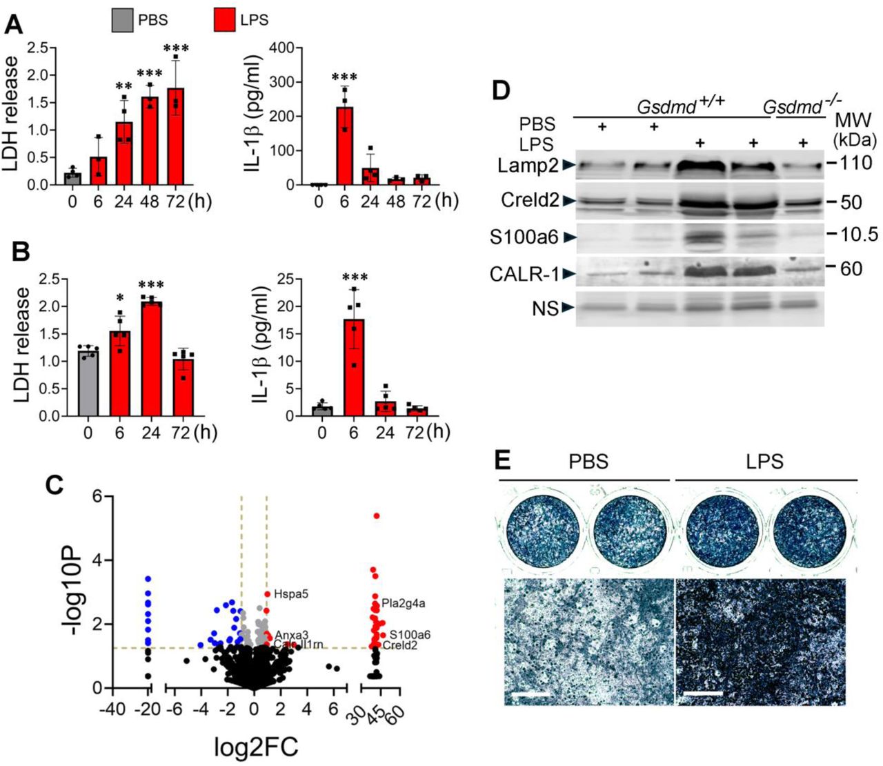 A, B ) Three- month-old WT male mice were injected with PBS or LPS (n= 3-4) and sacrificed at the indicated time points. Bone marrow supernatants collected from the tibias and femurs centrifuged in tubes containing 100 µl PBS (A) and serum (B) were used for LDH (OD values) and IL-1β analysis. C , D ) Three months old WT mice were i.p. injected with PBS (n=3) or 1 mg/kg LPS (n=3) on day 0 and sacrificed on day 3. Bone marrow was centrifuged, and the supernatants were collected and analyzed by mass spectrometry. C ) Volcano plot. D ) Three months old WT and Gsdmd -/- mice were i.p. injected with PBS or LPS on day 0 and sacrificed on day 3. The supernatants from centrifuged bone marrow were analyzed by immunoblotting. Each lane represents a sample from an individual mouse. E ) Periosteal cells from WT mice were isolated with collagenase and expanded for 1 week and cultured in osteogenic medium (50 μg/ml of ascorbic acid and 2 mM of glycerol 2-phosphate) for 3 days in the presence of bone marrow supernatants from mice treated with PBS or LPS for 3 days. Cells were stained for alkaline phosphatase activity. Top panels: images of whole wells. Bottom panels: high magnification images. Scale bar: 100 µm. <t>Lamp2,</t> lysosomal-associated membrane protein 2; Creld2, cysteine-rich with EGF-like domains 2; CALR, calreticulin; NS, nonspecific. *p<0.05, ***p<0.001, ****p<0.0001. 2-way ANOVA. 