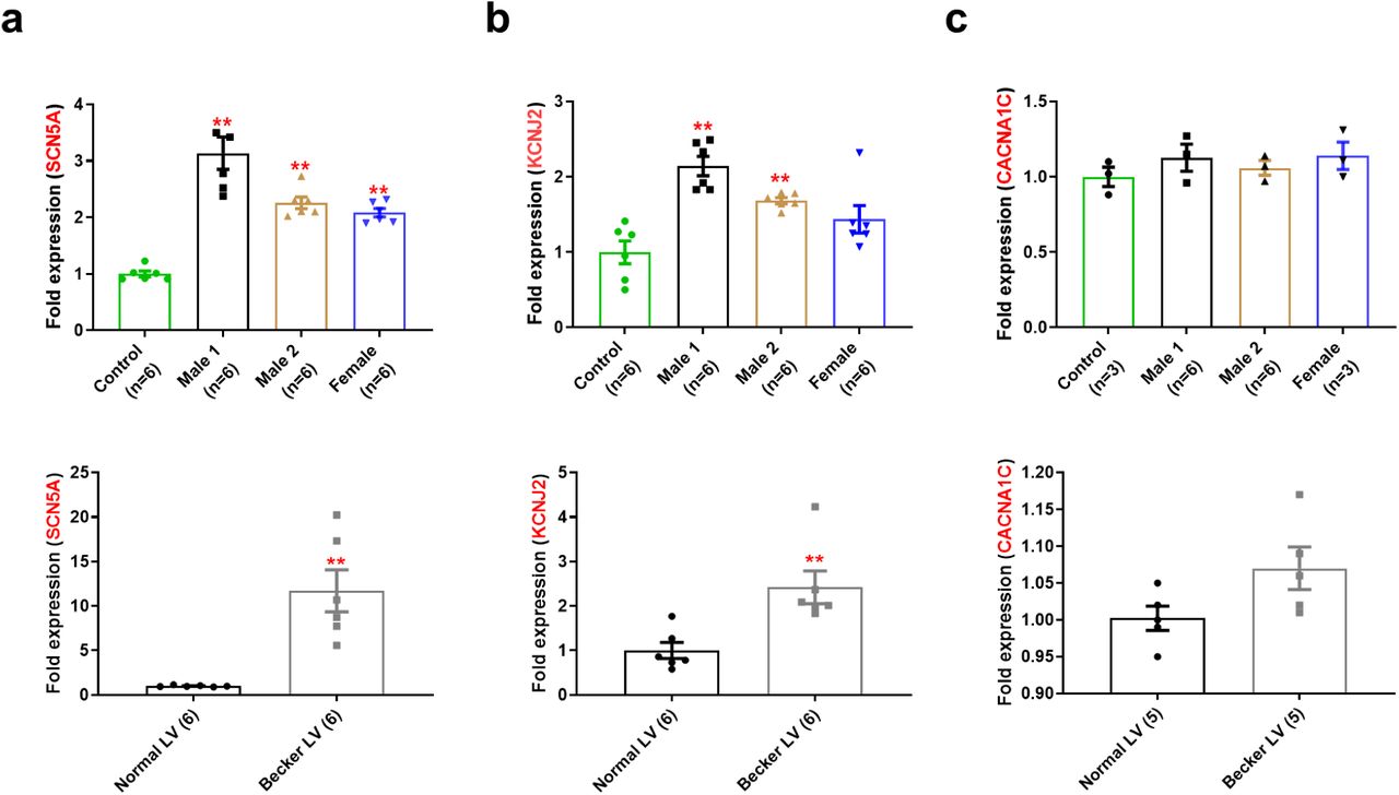 (a) SCN5A mRNA expression was increased in iPSC-CMs from hemizygous ... (a) SCN5A mRNA expression was increased in iPSC-CMs from hemizygous and heterozygous DMD individuals (top), as well as in the human left ventricle heart tissue from a Becker MD individual compared to a healthy subject (bottom). (b) KCNJ2 mRNA levels were higher in both hemizygous and heterozygous iPSC-CMs (top), like those found in human left ventricle heart tissue from Becker DM patients (bottom) when compared to the corresponding control. (c) CACNA1C mRNA expression was not significant different among tested groups from either iPSC-CMs (top) or left ventricle tissues (bottom). mRNA levels were determined by qRT-PCR and calculated by the comparative Ct method (2 -ddCt ) normalized to the internal control 18s rRNA. Errors bars represent SEM. The n -values are in parentheses. Two-tailed Mann-Whitney test. ** P < 0.005.