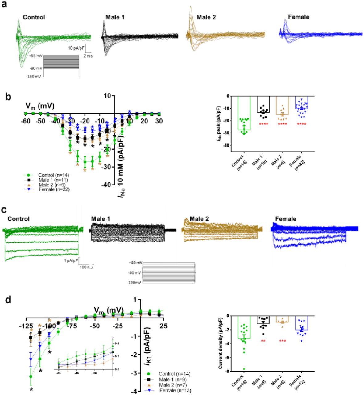 (a) Superimposed I Na current traces for Control 1, hemizygous and ... (a) Superimposed I Na current traces for Control 1, hemizygous and heterozygous iPSC-CMs elicited by the pulse protocol shown by the inset. (b) Left , normalized current-voltage (I/V) relationships. I Na was significantly reduced in both Male 1 and Male 2 iPSC-CMs compared with control at the specified voltages. Heterozygous female iPSC-CMs showed also a very reduced current density from 35 to 10 mV. Two-way analysis of variance (ANOVA) followed by Sidak’s multiple comparisons test. Right, peak I Na density at 20 mV was reduced in all three affected groups compared to control. (c) Typical I K1 density traces from control and DMD cells elicited by the pulse protocol in the inset . (d) Left , I/V relationships. I K1 was significantly reduced in both Male 1 and Male 2 iPSC-CMs compared with control at the specified voltages. Two-way ANOVA followed by Sidak’s multiple comparisons. Right, normalized current densities at -120 mV. I K1 was decreased in Male 1 and in Male 2 cells compared to control cells. Two-tailed Mann-Whitney test. Errors bars represent SEM. The n -values are in parentheses. ****P < 0.0001, ** P < 0.005 and * P < 0.05 and *P < 0.056.