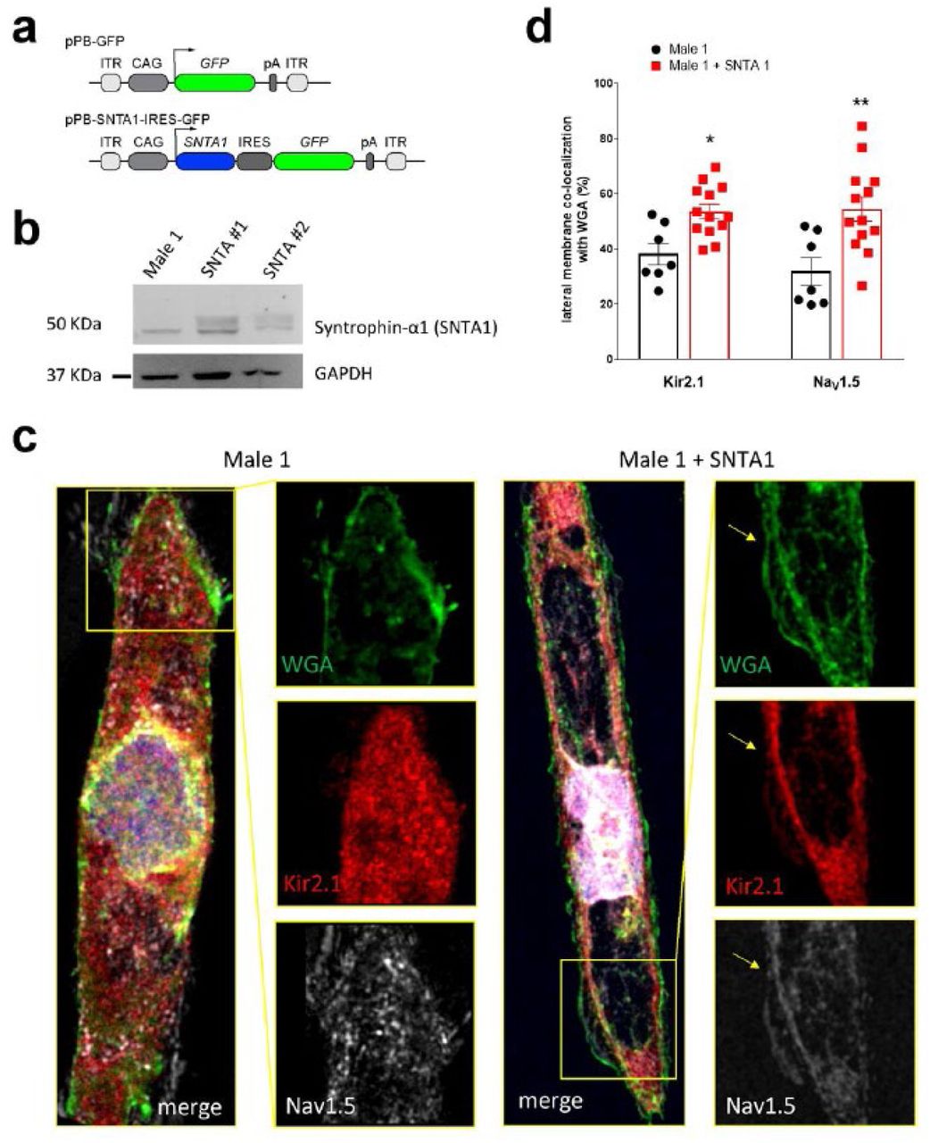 ... α-1-Syntrophin expression normalized with GAPDH. (c) Immunostaining for Kir2.1 (red), Na V 1.5 (white) and WGA (green) ... (a) Cartoon illustrating non-viral piggy-bac vector encoding SNTA1 for transfection in Male 1 iPSC-CMs. SNTA1 coding region (CDS) is driven by the CAG promoter and followed by green fluorescence protein (GFP) after an internal ribosome entry site (IRES). Control vector only expresses GFP. (b) Western blot for α-1-Syntrophin expression normalized with GAPDH. (c) Immunostaining for Kir2.1 (red), Na V 1.5 (white) and WGA (green) in control Male 1 iPSC-CM (left) and Male 1 iPSC-CM transfected with SNTA1 . Nuclei were stained with DAPI. Yellow arrows point to iPSC-CM membrane staining. Scale bar, 5 μm. (d) Quantification of Kir2.1 and Na V 1.5 colocalization with WGA at the cell membrane shows significant increase of both Kir2.1 ( *P < 0.05; n = 7–10 cells) and Na V 1.5 ( ** P < 0.01; n = 7–10 cells).