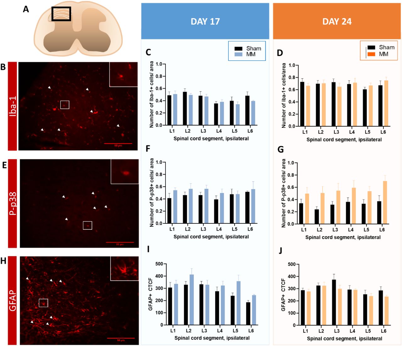 (A) Overview of the 347 x 260 µm2 area encompassing laminae I-IV of the dorsal horn in which Iba-1, Pp38 and GFAP were analysed. (B, E, H) Representative image of Iba1 + microglia cells (B), Pp38 + microglia cells (E) or GFAP + astrocytes (H) in the ipsilateral dorsal horn of the spinal cord (white arrowheads). (C, D, F, G) The relative number of Iba-1 + (C, D) or <t>P-p38</t> (F, G) microglia cells in the ipsilateral dorsal horn of the spinal cord of lumbar regions L1 to L6 was unchanged between MM and sham mice euthanized on day 17 or 24. (I, J) The level of normalized GFAP expression in the dorsal horn of the spinal cord was similar between MM and sham mice euthanized on post-surgical day 17 or 24. L=lumbar. Data are presented as mean ± SEM. Sham n=6-8; MM n=7-8.